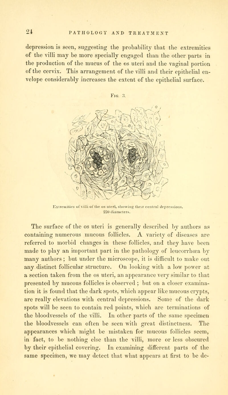 depression is seen, suggesting the probability that the extremities of the villi may be more specially engaged than the other parts in the production of the mucus of the os uteri and the vaginal portion of the cervix. This arrangement of the villi and their epithelial en- velope considerably increases the extent of the epithelial surface. Fig. 3. / O i Extremities of villi of llie os uteri, showing their central Oepressions. 220 diameters. The surface of the os uteri is generally described by authors as containing numerous mucous follicles. A variety of diseases are referred to morbid changes in these follicles, and they have been made to play an important part in the pathology of leucorrhoea by many authors; but under the microscope, it is difficult to make out any distinct follicular structure. On looking with a low power at a section taken from the os uteri, an appearance very similar to that presented by mucous follicles is observed ; but on a closer examina- tion it is found that the dark spots, which appear like mucous crypts, are really elevations with central depressions. Some of the dark spots will be seen to contain red points, which are terminations of the bloodvessels of the villi. In other parts of the same specimen the bloodvessels can often be seen with great distinctness. The appearances which might be mistaken for mucous follicles seem, in fact, to be nothing else than the villi, more or less obscured by their epithelial covering. In examining different parts of the same specimen, we may detect that what appears at first to be de-