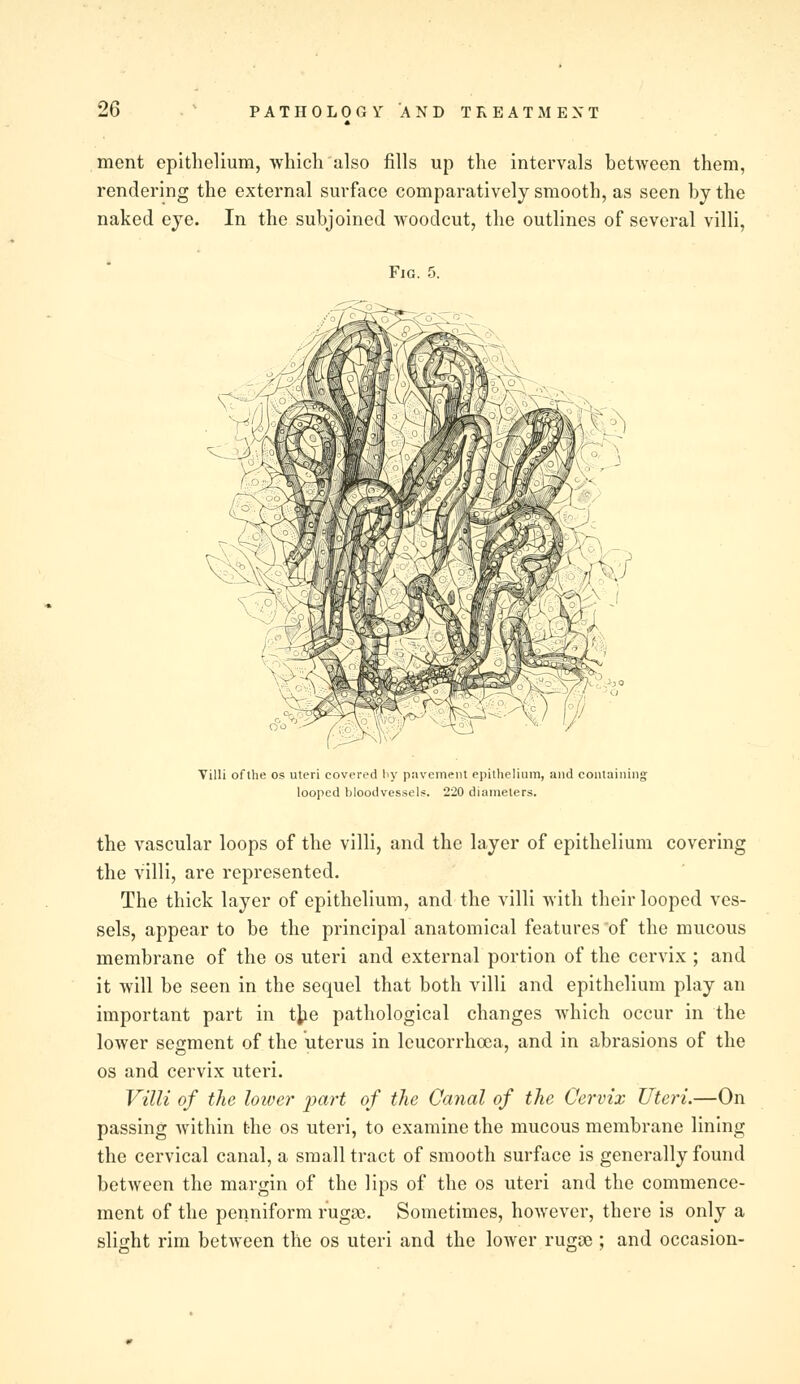 ment epithelium, which also fills up the intervals between them, rendering the external surface comparatively smooth, as seen by the naked eye. In the subjoined woodcut, the outlines of several villi, Fig. 5. Villi of the os uteri covered liy pavement epithelium, and containing looped bloodvessels. 220 diameters. the vascular loops of the villi, and the layer of epithelium covering the villi, are represented. The thick layer of epithelium, and the villi with their looped ves- sels, appear to be the principal anatomical features of the mucous membrane of the os uteri and external portion of the cervix ; and it will be seen in the sequel that both villi and epithelium play an important part in the pathological changes which occur in the lower segment of the uterus in leucorrhoca, and in abrasions of the os and cervix uteri. Villi of the lower part of the Canal of the Cervix Uteri.—On passing within the os uteri, to examine the mucous membrane lining the cervical canal, a small tract of smooth surface is generally found between the margin of the lips of the os uteri and the commence- ment of the penniform ruga3. Sometimes, however, there is only a slight rim between the os uteri and the lower rugoe ; and occasion-