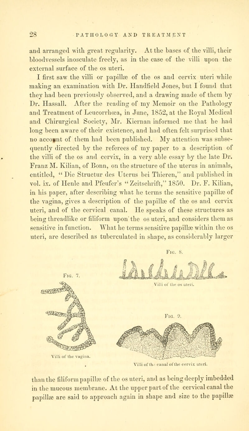 and arranged with great regularity. At the bases of the villi, their bloodvessels inosculate freely, as in the case of the villi upon the external surface of the os uteri. I first saw the villi or papillae of the os and cervix uteri while making an examination with Dr. Handfield Jones, but I found that they had been previously observed, and a drawing made of them by Dr. Hassall. After the reading of my Memoir on the Pathology and Treatment of Leucorrhoea, in June, 1852, at the Royal Medical and Chirurgical Society, Mr. Kiernan informed me that he had long been aware of their existence, and had often felt surprised that no account of them had been published. My attention was subse- quently directed by the referees of my paper to a description of the villi of the os and cervix, in a very able essay by the late Dr. Franz M. Kilian, of Bonn, on the structure of the uterus in animals, entitled,  Die Structur des Uterus bei Thieren, and published in vol. ix. of Henle and Pfeufer's  Zeitschrift, 1850. Dr. F. Kilian, in his paper, after describing what he terms the sensitive papillae of the vagina, gives a description of the papillae of the os and cervix uteri, and of the cervical canal. He speaks of these structures as being threadlike or filiform upon' the os uteri, and considers them as sensitive in function. What he terms sensitive papillae within the os uteri, are described as tuberculated in shape, as considerably larger Fig. S. Fig. 7. Villi of the vagina. Villi of llie os uteri. Fig. 0. Villi of th: canal of the cervix uteri. than the filiform papillae of the os uteri, and as being deeply imbedded in the mucous membrane. At the upper part of the cervical canal the papillae are said to approach again in shape and size to the papillae