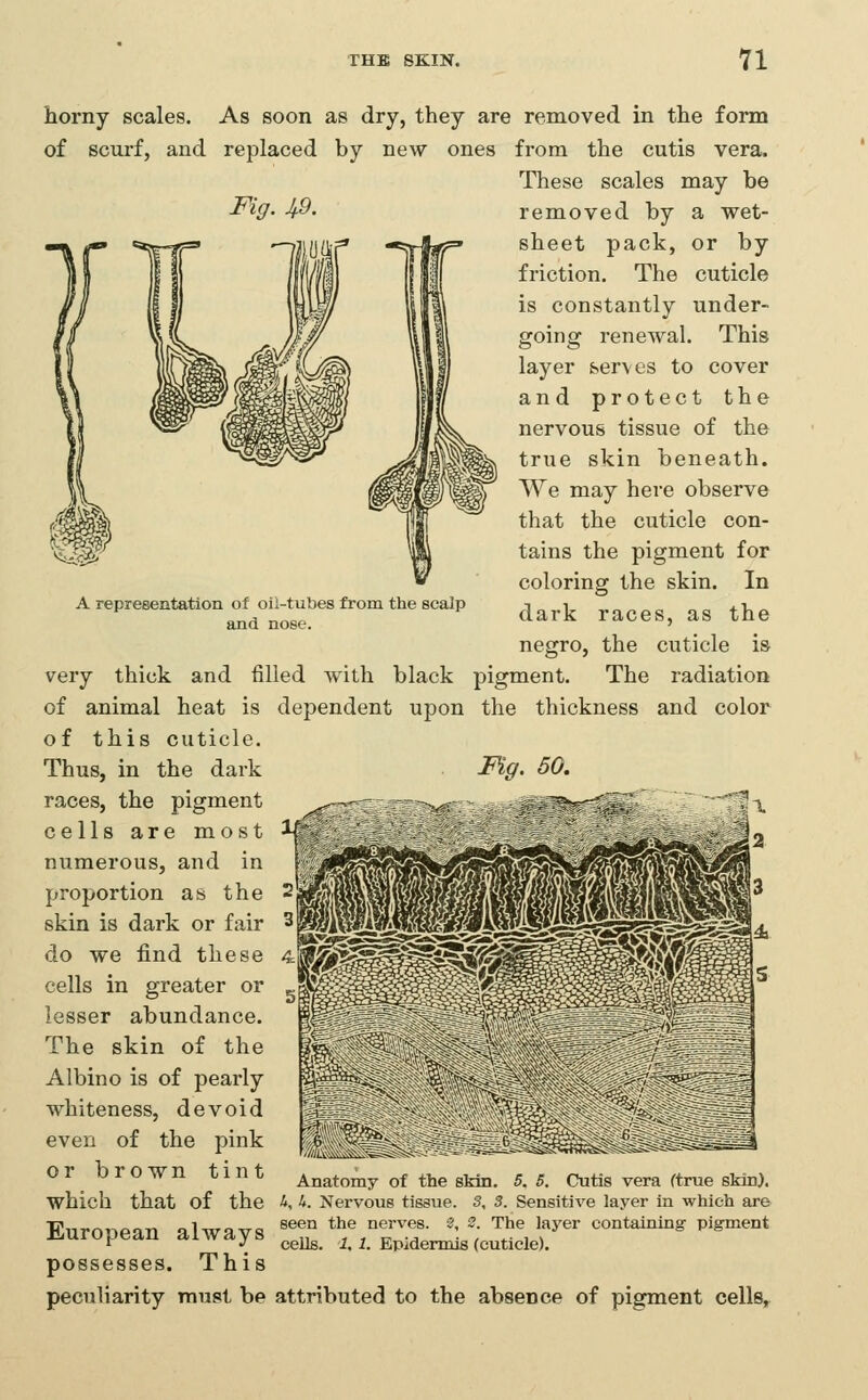 A representation of oil-tubes from the scalp and nose. horny scales. As soon as dry, they are removed in the form of scurf, and replaced by new ones from the cutis vera. These scales may be Fig. Jf9. removed by a wet- sheet pack, or by friction. The cuticle is constantly under- going renewal. This layer &.erves to cover and protect the nervous tissue of the true skin beneath. We may here observe that the cuticle con- tains the pigment for coloring the skin. In dark races, as the negro, the cuticle is very thick and filled Avith black pigment. The radiation of animal heat is dependent upon the thickness and color of this cuticle. Thus, in the dark Mg. 60. races, the pigment —— -^- - - «^^=ak.---^—r* ^ i cells are most numerous, and in proportion as the 2 skin is dark or fair 3 do we find these cells in greater or lesser abundance. The skin of the Albino is of pearly whiteness, devoid even of the pink Orbrown tint Anatomy of the skin. 5. 5. Cutis vera ftrue skin), which that of the 4, 4. Nervous tissue. 3, 3. Sensitive layer in which are European always seen the nerves. ^ 2 The layer containing pigment r J^ cells. 1.1. Epidermis (cuticle). possesses. This peculiarity must be attributed to the absence of pigment cells,