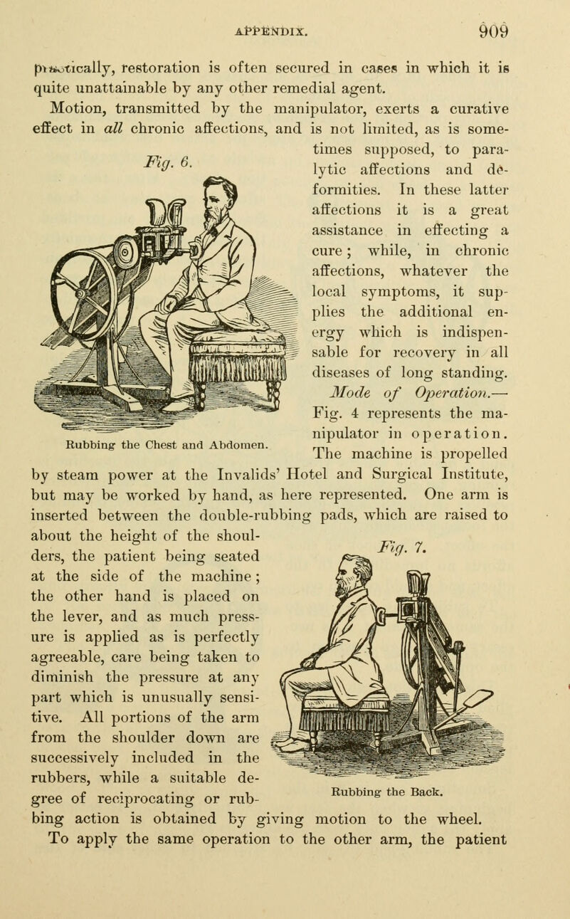 Rubbing- the Chest and Abdomen. p>ttvitically, restoration is often secured in cases in which it is quite unattainable by any other remedial agent. Motion, transmitted by the manipulator, exerts a curative effect in all chronic affections, and is not limited, as is some- times supposed, to para- ^^' ■ lytic affections and de- formities. In these latter affections it is a great assistance in effecting a cure; while, in chronic affections, whatever the local symptoms, it sup- plies the additional en- ergy which is indispen- sable for recovery in all diseases of long standing. Mode of Operation.— Fig. 4 represents the ma- nipulator in operation. The machine is propelled by steam power at the Invalids' Hotel and Surgical Institute, but may be worked by hand, as here represented. One arm is inserted between the double-rubbing pads, which are raised to about the height of the shoul- ders, the patient being seated *— ''* at the side of the machine; the other hand is placed on the lever, and as much press- ure is applied as is perfectly agreeable, care being taken to diminish the pressure at any part which is unusually sensi- tive. All portions of the arm from the shoulder dovsm are successively included in the rubbers, while a suitable de- gree of reciprocating or rub- bing action is obtained by giving motion to the wheel. To apply the same operation to the other arm, the patient