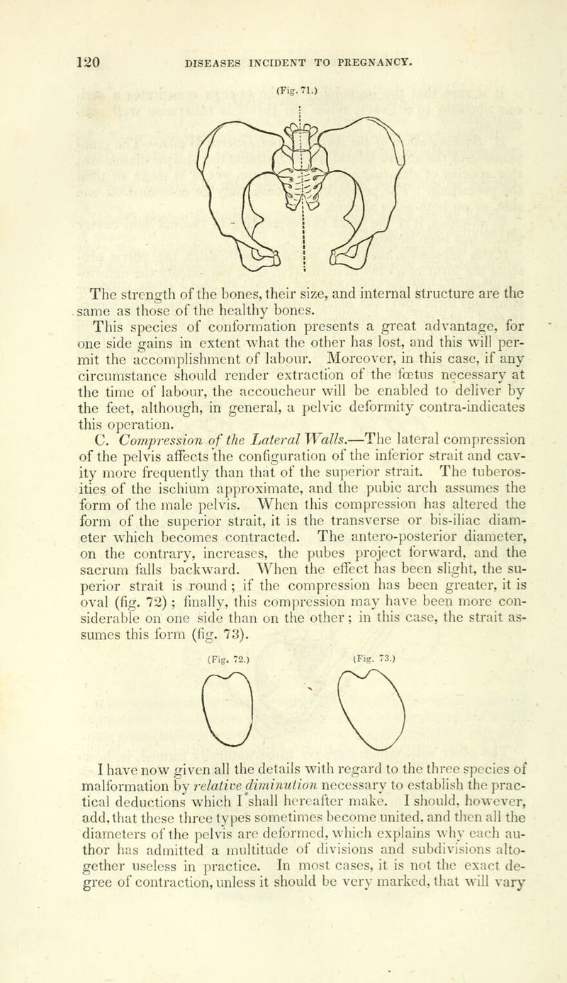 (Fig. 71.) The strength of the bones, their size, and internal structure are the same as those of the healthy bones. This species of conformation presents a great advantage, for one side gains in extent what the other has lost, and this will per- mit the accomplishment of labour. Moreover, in this case, if any circumstance should render extraction of the foetus necessary at the time of labour, the accoucheur will be enabled to deliver by the feet, although, in general, a pelvic deformity contra-indicates this operation. C. Compression of the Lateral Walls.—The lateral compression of the pelvis affects the configuration of the inferior strait and cav- ity more frequently than that of the superior strait. The tuberos- ities of the ischium approximate, and the pubic arch assumes the form of the male pelvis. When this compression has altered the form of the superior strait, it is the transverse or bis-iliac diam- eter which becomes contracted. The antero-posterior diameter, on the contrary, increases, the pubes project forward, and the sacrum falls backward. When the effect has been slight, the su- perior strait is round; if the compression has been greater, it is oval (fig. 72); finally, this compression may have been more con- siderable on one side than on the other; in this case, the strait as- sumes this form (fig. 73). I have now given all the details with regard to the three species of malformation by relative diminution necessary to establish the prac- tical deductions which I'shall hereafter make. I should, however, add, that these three types sometimes become united, and then all the diameters of the pelvis are deformed, which explains why each au- thor has admitted a multitude of divisions and subdivisions alto- gether useless in practice. In most cases, it is not the exact de- gree of contraction, unless it should be very marked, that will vary