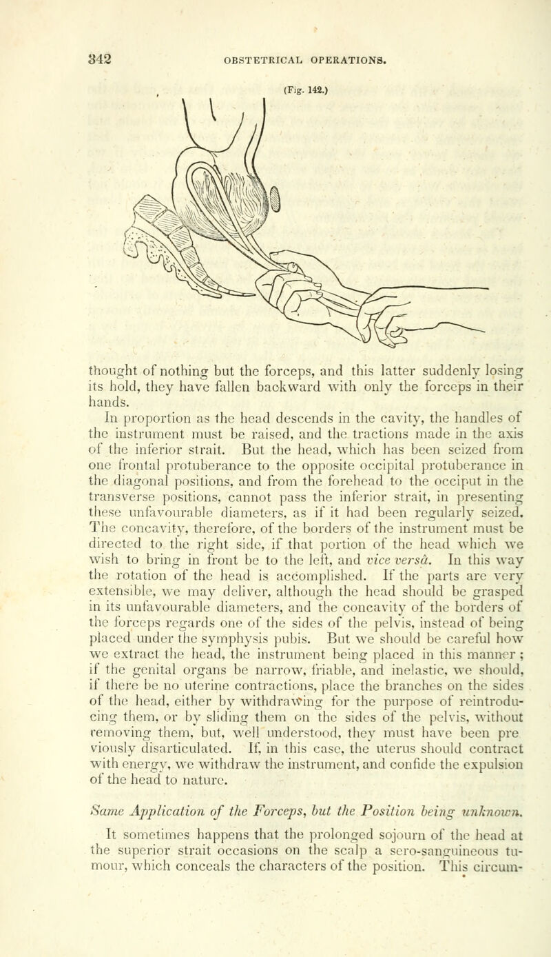 (Fig. 142.) thought of nothing but the forceps, and this latter suddenly losing its hold, they have fallen backward with only the forceps in their hands. In proportion as the head descends in the cavity, the handles of the instrument must be raised, and the tractions made in the axis of the inferior strait. But the head, which has been seized from one frontal protuberance to the opposite occipital protuberance in the diagonal positions, and from the forehead to the occiput in the transverse positions, cannot pass the inferior strait, in presenting these unfavourable diameters, as if it had been regularly seized. The concavity, therefore, of the borders of the instrument must be directed to the right side, if that portion of the head which we wish to bring in front be to the left, and vice versa. In this way the rotation of the head is accomplished. If the parts are very extensible, we may deliver, although the head should be grasped in its unfavourable diameters, and the concavity of the borders of the forceps regards one of the sides of the pelvis, instead of being placed under the symphysis pubis. But we should be careful how we extract the head, the instrument being placed in this manner ; if the genital organs be narrow, triable, and inelastic, we should, if there be no uterine contractions, place the branches on the sides of the head, either by withdrawing for the purpose of reintrodu- cing them, or by sliding them on the sides of the pelvis, without removing them, but, well understood, they must have been pre viously disarticulated. If, in this case, the uterus should contract with energy, we withdraw the instrument, and confide the expulsion of the head to nature. Same Application of the Forceps, but the Position being unknown. It sometimes happens that the prolonged sojourn of the head at the superior strait occasions on the scalp a sero-sanguineous tu- mour, which conceals the characters of the position. This circum-