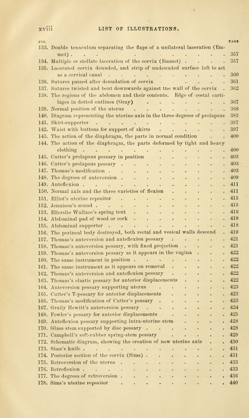 Fro. PAoi 133. Double tenaculum separating the flaps of a unilateral laceration (Em- met) ... . 357 134. Multiple or stellate laceration of the cervix (Emmet) .... 357 135. Lacerated cervix denuded, and strip of undenuded surface left to act as a cervical canal .......... 360 136. Sutures passed after denudation of cervix .... 361 137. Sutures twisted and bent downwards against the wall of the cervix . 362 138. The regions of the abdomen and their contents. Edge of costal carti- lages in dotted outlines (Gray) ....... 367 139. Normal position of the uterus 368 140. Diagram representing the uterine axis in the three degrees of prolapsus 383 141. Skirt-supporter 397 142. Waist with buttons for support of skirts ...... 397 143. The action of the diaphragm, the parts in normal condition . . 400 144. The action of the diaphragm, the parts deformed by tight and heavy clothing 400 145. Cutter's prolapsus pessary in position 403 146. Cutter's prolapsus pessary ......... 403 147. Thomas's modification 403 148. The degrees of anteversion ......... 409 149. Anteflexion 411 150. Normal axis and the three varieties of flexion ..... 411 151. Elliot's uterine repositor 415 152. Jennison's sound 415 153. EUerslie Wallace's spring tent 416 154. Abdominal pad of wood or cork 418 155. Abdominal supporter 418 156. The perineal body destroyed, both rectal and vesical walls descend . 419 157. Thomas's anteversion and anteflexion pessary 421 158. Thomas's anteversion pessary, with fixed projection .... 421 159. Thomas's anteversion pessary as it appears in the vagina . . . 422 160. The same instrument in position 422 161. The same instrument as it appears on removal 422 162. Thomas's anteversion and anteflexion pessary 422 163. Thomas's elastic pessary for anterior displacements .... 422 164. Anteversion pessary supporting uterus 423 165. Cutter's T-pessary for anterior displacements 423 166. Thomas's modification of Cutter's pessary 423 167. Graily Hewitt's anteversion pessary 424 168. Fowler's pessary for anterior displacements ..... 425 169. Anteflexion pessary supporting intra-uterine stem .... 428 170. Glass stem supported by disc pessary 428 171. Campbell's soft-rubber spring-stem pessary 429 172. Schematic diagram, showing the creation of new uterine axis . . 430 173. Sims's knife 431 174. Posterior section of the cervix (Sims) ....... 431 175. Retroversion of the uterus ......... 433 176. Retroflexion 433 177. The degrees of retroversion 436 178. Sims's uterine repositor ......... 440