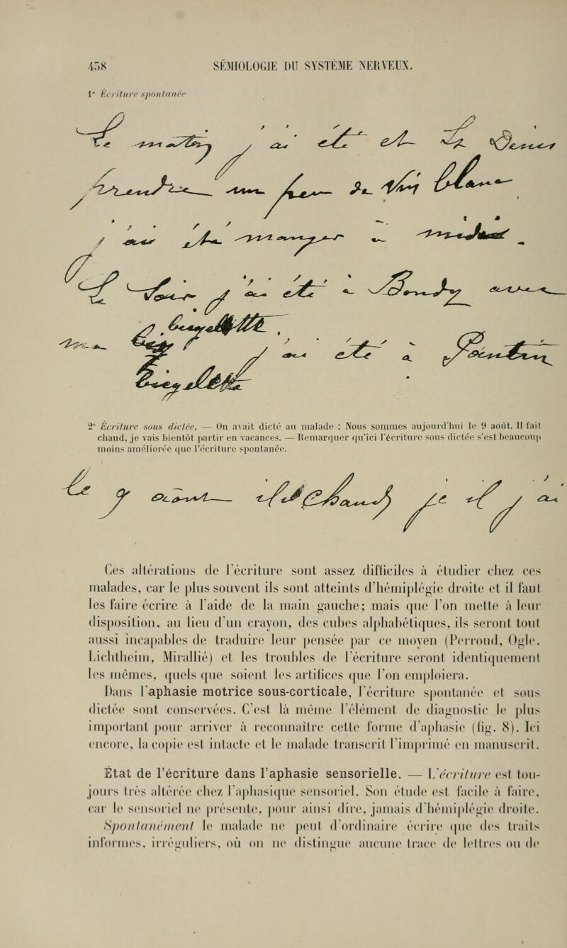 ^^5^^ 2 Écriture sous dictée. — On avait dicU' au malade : Nous sommes aujounlliui li^ 1» aoiU. Il lail chaud, je vais bientôt |Kirlir en vacances. — lieniar(|uer ((u'ici l'écriture sous dictée s'est heauconp moins améliorée que l'écriture spontanée. Ces allôralious de récritun! sont assez difficiles à étudier ehez ces malades, car le plus souvent ils sont atteints d'hémiplégie droite et il faul les faire écrire à laide de la main gauche; mais (pie l'on mette à leur disposition, au lieu dun crayon, des cuhes alphabétiques, ils seront tout aussi incapables de traduire leur pensée par ce moyen (Perroud, Oi>le. Lichtheim, Mirallié) et les troubles de l'écriture seront identitpieuienl les mêmes, (piels (pie soient les artilices (pie l'on em|)loiei'a. Dans l'aphasie motrice sous-corticale, l'écriture spontanée et sous dictée sont conservées. Cest là même Télément de diagnostic le plus important |)oui' arriver à recoimaili(> cette forme d a|)liasie (lig. 8). Ici encore, la copie est intacte et le malade lianscrit I iiiipiimé en manuscrit. État de l'écriture dans l'aphasie sensorielle. — \,\'cvihire est tou- jours très altérée elle/, rapliasi(pie sensoriel. Son étude est facile à faire, car l(( sensoriel ne présente, p(tiir ainsi dire, jamais d liéiiiiplégi(> droite. Sponlanrincnt le malade ne peut (rordinaire écrire (pie des traits informes, irréguliers, où on ne dislinyiie aucune trace de lettres ou de