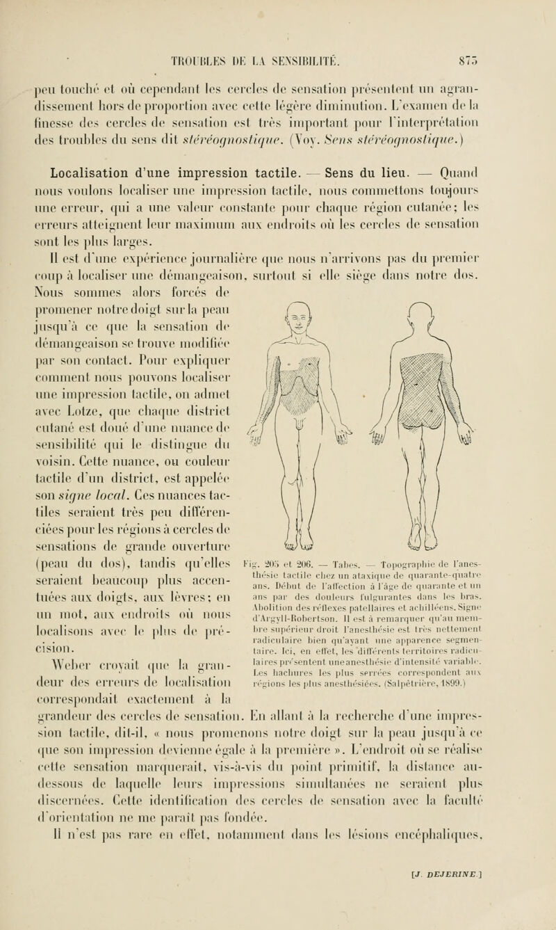 ])cu toiich('' et où cepondant les cercles de sensation présentent un agran- dissement hors de proportion avec cette légère diminution. L'examen de la finesse des cercles de sensation est très important ponr linterprétalion des tronbles du sens dit sfrréoçpinsfifjue. (Voy. Sens sieréofpiosfique.) Localisation d'une impression tactile. — Sens du lieu. — Quand nous voulons localiser une impression tactile, nous commettons toujours une erreur, qui a une valeur constante pour chaque région cutanée; les erreurs atteignent leur maximum aux endroits où les cercles de sensation sont les ]»lus larges. Il est d'une expérience journalière (pie nous narrivons pas du })remier coup à localiser une démangeaison, surtout si elle siège dans notre dos. Nous sommes alors forcés de promener notre doigt suila peau jusqu'à ce que la sensation de démangeaison se trouve modifiée par son contact. Pour expliquer comment nous pouvons localiser une impression tactile, on admet avec Lotze, que chaque district cutané est doué d'une nuance de sensibilité qui le distingue du voisin. Cette nuance, ou couleur- tactile d'un district, est appelée consigne local. Ces nuances tac- tiles seraient très peu différen- ciées pour les régions à cercles de sensations de grande ouverture (peau du dos), tandis qu'elles seraient beaucoup plus accen- tuées aux doigts, aux lèvres; en un mot, aux endroits où nous localisons avec le plus (\v pré- cision. Weber croyait que la gran- deur des cireurs de localisation Vv'. 'iiy.i l't 206. ■;il)f Topographio de l'anes- tht'sie tiiclilc chez un ataxiqiie de quarante-quatic an». Début du rairection à l'âge de quarante et un ans par des douleurs l'ulgurantes dans les bras. Al)olition des réflexes patellaires et acliilléens. Sigiif d'Aigyli-Robertson. Il est à remarquer qu'au meui- bie supérieur droit l'anestbésie est 1res nettement radiculaire bien qu'ayant une apparence segmen- tnire. Ici, eu eflet, les différents territoires radicu- laires présentent uneanestliésie d'intensité variablr. Les hacliures les plus serrées correspondent :\u\ régions les plus anesthésiées. (Salpètiièio, 1S99.) correspondait exactement à la grandeur des cercles de sensation. En allant à la recherche d'une impres- sion tactile, dit-il, « nous promenons notre doigt sur la peau jusqu'à ce ([ue son impression devienne égale à la jiremière ». L'endroit où se réalise cette sensation marquerait, vis-à-vis du point primitif, la distance au- dessous de laquelle leurs impressions simultanées ne seraient plus discernées. Cette identification des cercles de sensation avec la faculté dorientiition ne me jtarait ])ns fondée. il n'est pas rare en (dfet, notammenl dans b's lésions encépbali([ues.