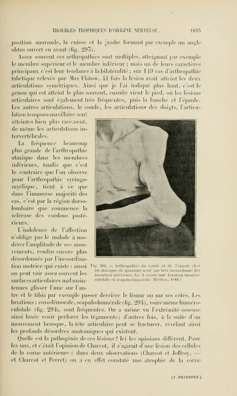 position anoi'iiialo, la ciiisso et la jainhc roniianl par ('xi'iiiplc un aii;j;l(' obtus ouvert en avant (tl^. '295 ). Assez souvent ces aifhropathies sont nniltiples. atteignant par exemple le membre supérieur et le nieuibrc inférieur ; mais un de lems caractères principaux c'est leur tendance à labilatéralité : sur 1 iî) cas d arlbropathie tal)éti([ue relevés par Max Flatow, 41 fois la lésion avait atteint les deux articulations symétriques. Ainsi que je Tai indiqué plus liant, c est le genou qui est atteint le plus souvent, ensuite vient le pied, où les lésions articulaii'es sont éiialement très fréquentes, puis la lianclie et lépaule. Les autres articulations, le coude, les articulatiouï* des doigts, l'articu- lation temporo-maxillaire sont atteintes bien plus rai-e;iient, de même les articulations in- tervertébrales. La fré(pience l)eaucoup plus grande de l'arthropatliie ataxique dans les niend)res inférieurs, tandis que c'est le contraire que Ton observe pou]' l'artbropathie syringo- myélique, tient à ce (pie clans l'immense majorité des cas, c'est par la région dorso- lombaire que commence la sclérose des cordons posté- rieurs. L'indolence de l'airection n'oblige pas le malade à mo- dérer Tamplitude de ses mou- vements, rendus encore plus désordonnés par l'incoordina- tion motrice qui existe : aussi '''iy- -•'^- — Ariiiropaiiiie du c.nuir vi dr (•.•■|i;iuir rh-z , .^ ^ ^ ,1 lin ataxique (le quaranle-nt'Ul' ans très incooi'donné dos on peut VOU assez souvent les memlires inférieurs. Ici il existe une luxation huiuéio- .surfacesarticulaires mal main- '-^'hw.iU- et scapuio-huméraie. (Dicêtie, mo.} tenues glisser Lune sur l'au- tre et le tibia par exemple passer derrière le fémur ou sur ses côlés. Les luxations : coxo-fémoral(\ scapiilo-luimérale((ig. 294), voire même binuéro- ^■ubitale (fig. 294), sont frécpienles. On a même vu l'exlrémilé osseuse ainsi luxée venir perforer les tégunu'uts; d'antres fois, à la suite d'un mouvement brusque, la tète articulaire j)eut se fractui'ei'. révélant ainsi les profonds désordres anatoini([ues (pii existent. Quelle est la patliogénie de ces lésions? Ici les o|)inions dilVèrent. Pour les uns, et c'.était l'opinion de Charcot, il s'aginiit d'une lésion des cellules de la corne antérieur(^ : dans deux observations (Cbarcol et JollVoy, — et Cbarcot e! Perret) on a en cll'el constaté une alropliir de la corne