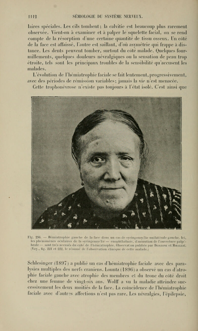 laires spéciales. Les cils toiiiliont; la calvitie est heaucoiip jtliis rarement observée. Yient-on à exaniiner et à palper le squelette facial, on se rend oonijite de la résorption d une certaine (juantité de tissu osseux. Un coté de la face est affaissé, 1 autre est saillant, d Où asymétrie qui fi'appe à dis- tance. Les dents peuvent tondjcr, surtout du côté malade. (Juehpies foui- niillements, quelques douleurs névralj^iques ou la sensation de jieau trop étroite, tels sont les princi|)aux troubles de la sensibilité (ju'accusent les malades. L'évolution de riiémiatrojdiie faciale se fait lentement, proj^fressivement, avec des périodes de rémission variables; jamais la vie n'est menacée. Cette tropbonévrose n'existe |)as toujours à létat isolé. C est ainsi que V\g. 296. — llémiatl'0|)liic ^andi.' de l:i Uiri' dans un cMS de s\ rin-diiiy.'lic iiiiilal i'i:ilc i;nucli<\ Ici, les iilu'noiiièiies ociilairrs ilo hi >yiinj;iiiiiyi'lio — fiioplillialiDif. diiiiiiiiilion de rniivcLtiiiT [lalpc'- brale — sont trils accii.sc's du côlr de l'iiéiuialropliie. OItservaLon piihliro par Kimiium; et iMirallik. (Voy., fig. 221 et 222, le riMiinr do l'oh^ervalion clinif|iie de celle malade.) Scblesinifer (I8!)7) a |iublié un cas (rbémialro|)lue faciale avec des para- lysies multiples des nerfs crâniens. Lount/( 18i)(i) a observé un cas d'atro- phie faciale gauche avec atro|)lue des meuibres el du tronc du côté droit chez vme femme de vingt-six ans. Wolfl a vu la maladie atteindre suc- cessivement les deux moitiés de la face. La coïncidence de riiémiatropbie faciale avec d'aulr!2s alfections n'est pas rare. Les névralgies, l'épilepsie,