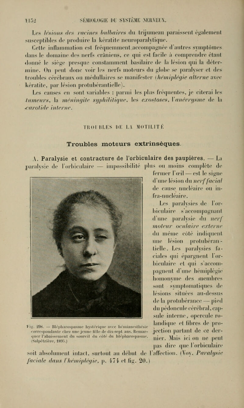 Les lésions <l('s racines hnlhaircs du Irijiinicaii piii'.iisscnl (''iiiilciiionl siiscoplihlcs tic juodiiiic 1;( kc'iiitilo nouroparalytiquc Cott»' iiillamniiilion est iV(''(|iii'iniii(Mil.ai'coni|)a^n(''c d'antres symptômes tians le domaine des neil's eiàniens. ce qni est facile à comprendic étant donné le siènc pi'es(pii> constanmu'nt l)asilaire de la lésion qui la détor- juine. On peut donc voir li's nei'ls moteurs du ^lol»e se |)ni'alyser et des trouhles céiél)iaiix ou médidlaires se manilester [lu'ntiiidcijic allcrne avec kératite, par lésion protubérantielle). Les causes en sont variables : parmi les i>lus IVéquentes, je citerai les Jtinii'urs, la inéuinc/ilc si//tliilili(iu(\ l«'s exosloses, Va)wrri/sme de la 4-(iroli(lt' i)ilr}'ne. TItdl liLKS l)K LA MdïlLITl': Troubles moteurs extrinsèques. A. Paralysie et contracture de rorbiculaire des paupières. — La l^arahsie de rorbiculaire — iuqtossibilité plus ou moins complète de lermer To'il — est le signe I (Tune lésion du nerf facial de cause nucléaire ou in- IVa-nucléaii'e. Les paraivsies de Tm- bicidaire s'accompagnant crune paralysie du nerf moteur oculaire externe du uuMue côté indiquent une lésion protubéran- tielle. Les i>aralysies fa- ciales ([ui épargnent l'or- biculaire et qui s'accom- ])agnent d'une bémiplégie bomonvme i\vs ni<>mbres sont svmplomatiques de lésions situées au-dessus de la prol(d)érance — pied (\u pédonculecéiébi'al,cap- sule interne. open'ule ro- ... „ „.. . , . Iandi(|ue cl libres de v»'- rig'. is)A. — Bli'|)li;ii'os])asmo hysloiu|iio avec iR'iiiiancsUu'sic . . ' ' ■ orrespondanle cliez iiiK'jonn.'lillc (If ilix-sepl ans. Reniai- JCCtlOU parlant de CQ dcr- qu.T l'abaissement rtn MMirril du roi/, au lU/.pl^ j, y|,,j^ j,.; ,^,^ ,^^, ^ (Salpetnerc. 180;>.) , . ' . pas dii'c ipie lOibiculaire soit absolumenl iulacl, surloul au déiiul de lalfeclion. (Voy. Parahjsie faciale dans riiénii/tlé</ie. p. i7i et lig. 20.)