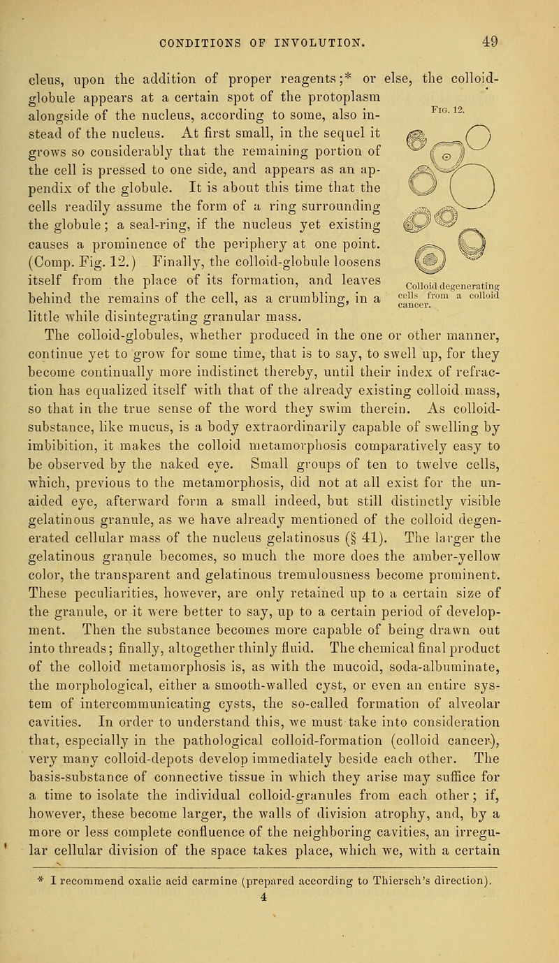 Fig. 12. Colloid degenerating cells from a colloid cleus, upon the addition of proper reagents;* or else, the colloid globule appears at a certain spot of the protoplasm alongside of the nucleus, according to some, also in- stead of the nucleus. At first small, in the sequel it grows so considerably that the remaining portion of the cell is pressed to one side, and appears as an ap- pendix of the globule. It is about this time that the cells readily assume the form of a ring surrounding the globule; a seal-ring, if the nucleus yet existing causes a prominence of the periphery at one point. (Comp. Fig. 12.) Finally, the colloid-globule loosens itself from the place of its formation, and leaves behind the remains of the cell, as a crumbling, in a little while disintegrating granular mass. The colloid-globules, whether produced in the one or other manner, continue yet to grow for some time, that is to say, to swell up, for they become continually more indistinct thereby, until their index of refrac- tion has equalized itself with that of the already existing colloid mass, so that in the true sense of the word they swim therein. As colloid- substance, like mucus, is a body extraordinarily capable of swelling by imbibition, it makes the colloid metamorphosis comparatively easy to be observed by the naked eye. Small groups of ten to twelve cells, which, previous to the metamorphosis, did not at all exist for the un- aided eye, afterward form a small indeed, but still distinctly visible gelatinous granule, as we have already mentioned of the colloid degen- erated cellular mass of the nucleus gelatinosus (§ 41). The larger the gelatinous granule becomes, so much the more does the amber-yellow color, the transparent and gelatinous tremulousness become prominent. These peculiarities, however, are only retained up to a certain size of the granule, or it were better to say, up to a certain period of develop- ment. Then the substance becomes more capable of being drawn out into threads; finally, altogether thinly fluid. The chemical final product of the colloid metamorphosis is, as with the mucoid, soda-albuminate, the morphological, either a smooth-walled cyst, or even an entire sys- tem of intercommunicating cysts, the so-called formation of alveolar cavities. In order to understand this, we must take into consideration that, especially in the pathological colloid-formation (colloid cancer), very many colloid-depots develop immediately beside each other. The basis-substance of connective tissue in which they arise may suffice for a time to isolate the individual colloid-granules from each other; if, however, these become larger, the walls of division atrophy, and, by a more or less complete confluence of the neighboring cavities, an irregu- lar cellular division of the space takes place, which we, with a certain * I recommend oxalic acid carmine (prepared according to Thiersch's direction). 4