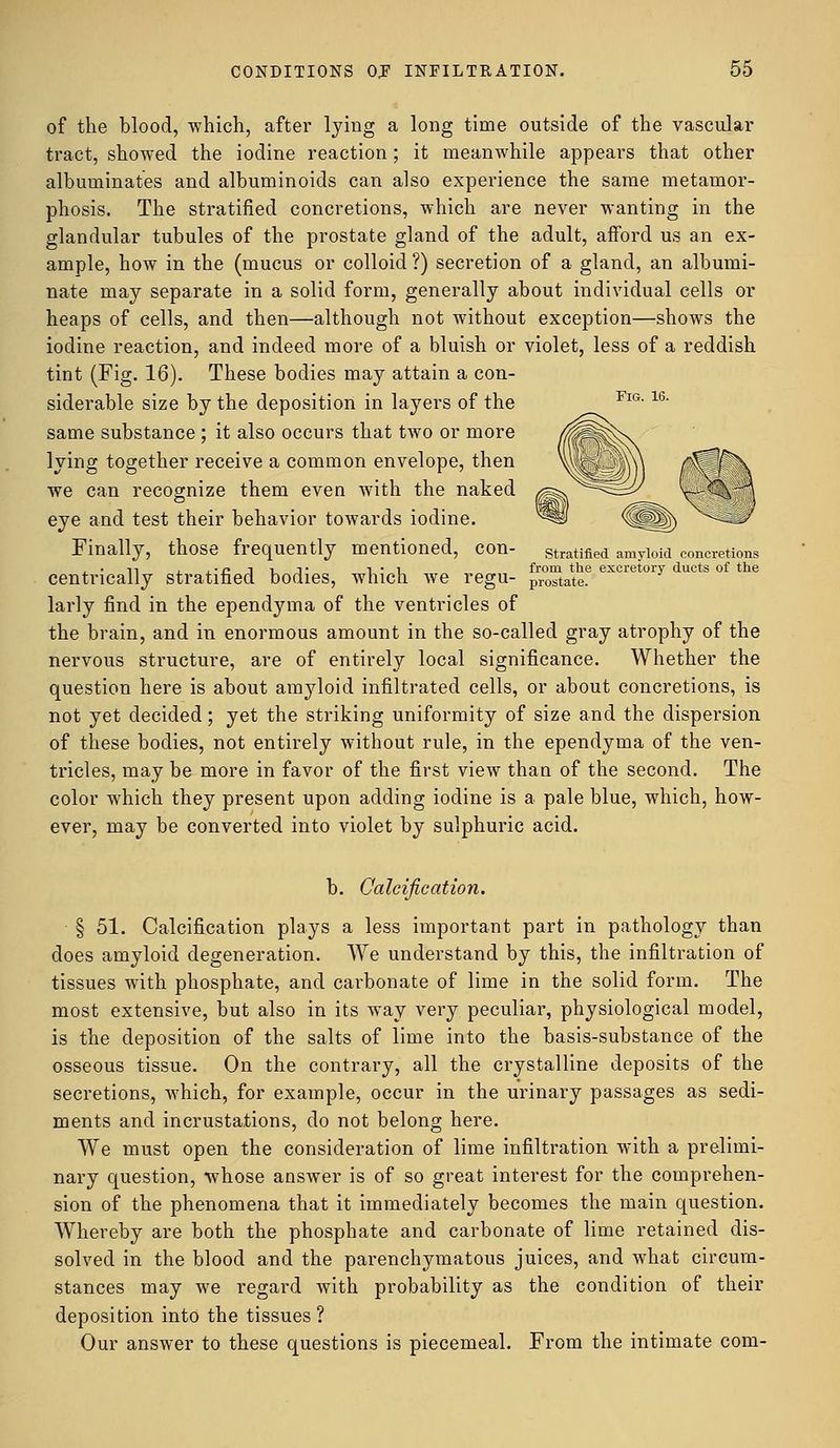 of the blood, which, after lying a long time outside of the vascular tract, showed the iodine reaction; it meanwhile appears that other albuminates and albuminoids can also experience the same metamor- phosis. The stratified concretions, which are never wanting in the glandular tubules of the prostate gland of the adult, afford us an ex- ample, how in the (mucus or colloid ?) secretion of a gland, an albumi- nate may separate in a solid form, generally about individual cells or heaps of cells, and then—although not without exception—shows the iodine reaction, and indeed more of a bluish or violet, less of a reddish tint (Fig. 16). These bodies may attain a con- siderable size by the deposition in layers of the same substance ; it also occurs that two or more lying together receive a common envelope, then we can recognize them even with the naked eye and test their behavior towards iodine. Finally, those frequently mentioned, con- stratified amyloid concretions . • n ,■/• j t. j- i-i from the excretory ducts of the centncally stratified bodies, which we regu- pr0state. larly find in the ependyma of the ventricles of the brain, and in enormous amount in the so-called gray atrophy of the nervous structure, are of entirely local significance. Whether the question here is about amyloid infiltrated cells, or about concretions, is not yet decided; yet the striking uniformity of size and the dispersion of these bodies, not entirely without rule, in the ependyma of the ven- tricles, may be more in favor of the first view than of the second. The color which they present upon adding iodine is a pale blue, which, how- ever, may be converted into violet by sulphuric acid. b. Calcification. § 51. Calcification plays a less important part in pathology than does amyloid degeneration. We understand by this, the infiltration of tissues with phosphate, and carbonate of lime in the solid form. The most extensive, but also in its way very peculiar, physiological model, is the deposition of the salts of lime into the basis-substance of the osseous tissue. On the contrary, all the crystalline deposits of the secretions, which, for example, occur in the urinary passages as sedi- ments and incrustations, do not belong here. We must open the consideration of lime infiltration with a prelimi- nary question, whose answer is of so great interest for the comprehen- sion of the phenomena that it immediately becomes the main question. Whereby are both the phosphate and carbonate of lime retained dis- solved in the blood and the parenchymatous juices, and what circum- stances may we regard with probability as the condition of their deposition into the tissues ? Our answer to these questions is piecemeal. From the intimate com-