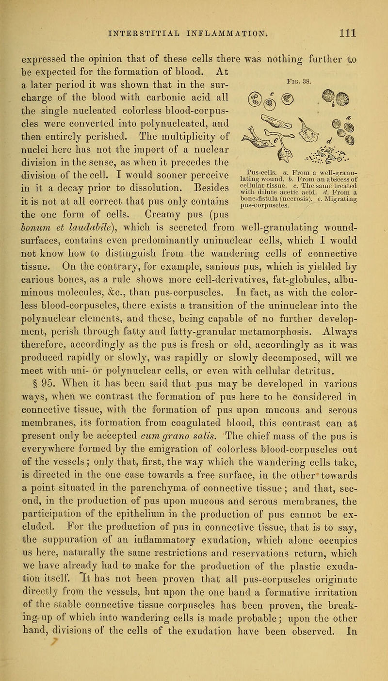 expressed the opinion that of these cells there was nothing further to be expected for the formation of blood. At a later period it was shown that in the sur- charge of the blood with carbonic acid all the single nucleated colorless blood-corpus- cles were converted into polynucleated, and then entirely perished. The multiplicity of nuclei here has not the import of a nuclear division in the sense, as when it precedes the division of the cell. I would sooner perceive J^lt^Zn* Zt!™Z} in it a decay prior to dissolution. Besides SftSSEatto STfiSSI it is not at all correct that pus only contains JSSSSSfif0^ * Migrating the one form of cells. Creamy pus (pus bonum et laudabile), which is secreted from well-granulating wound- surfaces, contains even predominantly uninuclear cells, which I would not know how to distinguish from the wandering cells of connective tissue. On the contrary, for example, sanious pus, which is yielded by carious bones, as a rule shows more cell-derivatives, fat-globules, albu- minous molecules, &c, than pus-corpuscles. In fact, as with the color- less blood-corpuscles, there exists a transition of the uninuclear into the polynuclear elements, and these, being capable of no further develop- ment, perish through fatty and fatty-granular metamorphosis. Always therefore, accordingly as the pus is fresh or old, accordingly as it was produced rapidly or slowly, was rapidly or slowly decomposed, will we meet with uni- or polynuclear cells, or even with cellular detritus. § 95. When it has been said that pus may be developed in various ways, when we contrast the formation of pus here to be considered in connective tissue, with the formation of pus upon mucous and serous membranes, its formation from coagulated blood, this contrast can at present only be accepted cum grano salis. The chief mass of the pus is everywhere formed by the emigration of colorless blood-corpuscles out of the vessels ; only that, first, the Avay which the wandering cells take, is directed in the one case towards a free surface, in the other towards a point situated in the parenchyma of connective tissue; and that, sec- ond, in the production of pus upon mucous and serous membranes, the participation of the epithelium in the production of pus cannot be ex- cluded. For the production of pus in connective tissue, that is to say, the suppuration of an inflammatory exudation, which alone occupies us here, naturally the same restrictions and reservations return, which we have already had to make for the production of the plastic exuda- tion itself. It has not been proven that all pus-corpuscles originate directly from the vessels, but upon the one hand a formative irritation of the stable connective tissue corpuscles has been proven, the break- ing, up of which into wandering cells is made probable; upon the other hand, divisions of the cells of the exudation have been observed. In