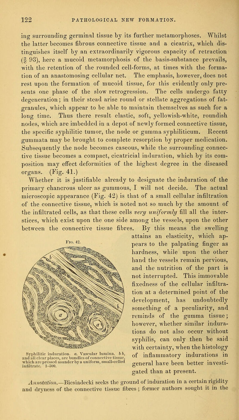 ing surrounding germinal tissue by its further metamorphoses. Whilst the latter becomes fibrous connective tissue and a cicatrix, which dis- tinguishes itself by an extraordinarily vigorous capacity of retraction (§ 93), here a mucoid metamorphosis of the basis-substance prevails, with the retention of the rounded cell-forms, at times with the forma- tion of an anastomosing cellular net. The emphasis, however, does not rest upon the formation of mucoid tissue, for this evidently only pre- sents one phase of the slow retrogression. The cells undergo fatty degeneration; in their stead arise round or stellate aggregations of fat- granules, which appear to be able to maintain themselves as such for a long time. Thus there result elastic, soft, yellowish-white, roundish nodes, which are imbedded in a depot of newly formed connective tissue, the specific syphilitic tumor, the node or gumma syphiliticum. Recent gummata may be brought to complete resorption by proper medication. Subsequently the node becomes caseous, while the surrounding connec- tive tissue becomes a compact, cicatricial induration, which by its com- position may effect deformities of the highest degree in the diseased organs. (Fig. 41.) Whether it is justifiable already to designate the induration of the primary chancrous ulcer as gummous, I will not decide. The actual microscopic appearance (Fig. 42) is that of a small cellular infiltration of the connective tissue, which is noted not so much by the amount of the infiltrated cells, as that these cells very uniformly fill all the inter- stices, which exist upon the one side among the vessels, upon the other between the connective tissue fibres. By this means the swelling attains an elasticity, which ap- pears to the palpating finger as hardness, while upon the other hand the vessels remain pervious, and the nutrition of the part is not interrupted. This immovable fixedness of the cellular infiltra- tion at a determined point of the development, has undoubtedly something of a peculiarity, and reminds of the gumma tissue; however, whether similar indura- tions do not also occur without syphilis, can only then be said w7ith certainty, when the histology of inflammatory indurations in general have been better investi- gated than at present. Annotation,— Biesiadecki seeks the ground of induration in a certain rigidity and dryness of the connective tissue fibres ; former authors sought it in the Syphilitic induration, a. Vascular lumina. 6 6, and all clear places, are bundles of connective tissue, which are pressed asunder bya uniform, small-celled infiltrate. 1-300.