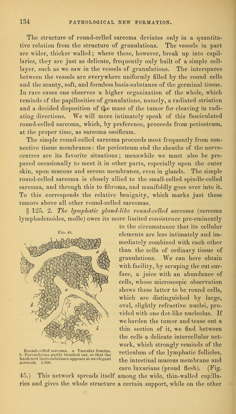 The structure of round-celled sarcoma deviates only in a quantita- tive relation from the structure of granulations. The vessels in part are wider, thicker walled; where these, however, break up into capil- laries, they are just as delicate, frequently only built of a simple cell- layer, such as we saw in the vessels of granulations. The interspaces between the vessels are everywhere uniformly filled by the round cells and the scanty, soft, and formless basis-substance of the germinal tissue. In rare cases one observes a higher organization of the whole, which reminds of the papillosities of granulations, namely, a radiated striation and a decided disposition of the mass of the tumor for cleaving in radi- ating directions. We will more intimately speak of this fasciculated round-celled sarcoma, which, by preference, proceeds from periosteum, at the proper time, as sarcoma ossificum. The simple round-celled sarcoma proceeds most frequently from con- nective tissue membranes : the periosteum and the sheaths of the nerve- centres are its favorite situations; meanwhile Ave must also be pre- pared occasionally to meet it in other parts, especially upon the outer skin, upon mucous and serous membranes, even in glands. The simple round-celled sarcoma is closely allied to the small-celled spindle-celled sarcoma, and through this to fibroma, and manifoldly goes over into it. To this corresponds the relative benignity, which marks just these tumors above all other round-celled sarcomas. § 125. 2. The lymphatic gland-like round-celled sarcoma (sarcoma lymphadenoides, molle) owes its more limited consistence pre-eminently to the circumstance that its cellular elements are less intimately and im- mediately combined with each other than the cells of ordinary tissue of granulations. We can here obtain with facility, by scraping the cut sur- face, a juice with an abundance of cells, whose microscopic observation shows these latter to be round cells, which are distinguished by large, oval, slightly refractive nuclei, pro- vided with one dot-like nucleolus. If we harden the tumor and tease out a thin section of it, we find between the cells a delicate intercellular net- work, which strongly reminds of the reticulum of the lymphatic follicles, the intestinal mucous membrane and caro luxurians (proud flesh). (Fig. 45.) This network spreads itself among the wide, thin-walled capilla- ries and gives the whole structure a certain support, while on the other Fig. 45. Round-celled sarcoma, a. Vascular lumina. h. Parenchyma partly brushed out, so tbat the hardened basis-substance appears as an elegant network. 1-300.