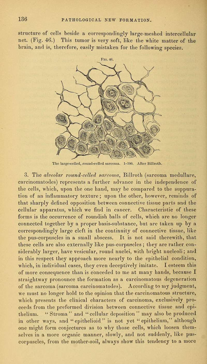 structure of cells beside a correspondingly large-meshed intercellular net. (Fig. 46.) This tumor is very soft, like the white matter of the brain, and is, therefore, easily mistaken for the following species. Fig. 46. The large-celled, round-celled sarcoma. 1-300. After Billroth. 3. The alveolar round-celled sarcoma, Billroth (sarcoma medullare, carcinomatodes) represents a further advance in the independence of the cells, which, upon the one hand, may be compared to the suppura- tion of an inflammatory texture; upon the other, however, reminds of that sharply defined opposition between connective tissue parts and the cellular apparatus, which we find in cancer. Characteristic of these forms is the occurrence of roundish balls of cells, which are no longer connected together by a proper basis-substance, but are taken up by a correspondingly large cleft in the continuity of connective tissue, like the pus-corpuscles in a small abscess. It is not said therewith, that these cells are also externally like pus-corpuscles ; they are rather con- siderably larger, have vesicular, round nuclei, with bright nucleoli; and in this respect they approach more nearly to the epithelial condition, which, in individual cases, they even deceptively imitate. I esteem this of more consequence than is conceded to me at many hands, because I straightway pronounce the formation as a carcinomatous degeneration of the sarcoma (sarcoma carcinomatodes). According to my judgment, we must no longer hold to the opinion that the carcinomatous structure, which presents the clinical characters of carcinoma, exclusively pro- ceeds from the preformed division between connective tissue and epi- thelium.  Stroma and cellular deposition  may also be produced in other ways, and  epithelioid  is not yet  epithelium, although one might form conjectures as to why those cells, which loosen them- selves in a more organic manner, slowly, and not suddenly, like pus- corpuscles, from the mother-soil, always show this tendency to a more