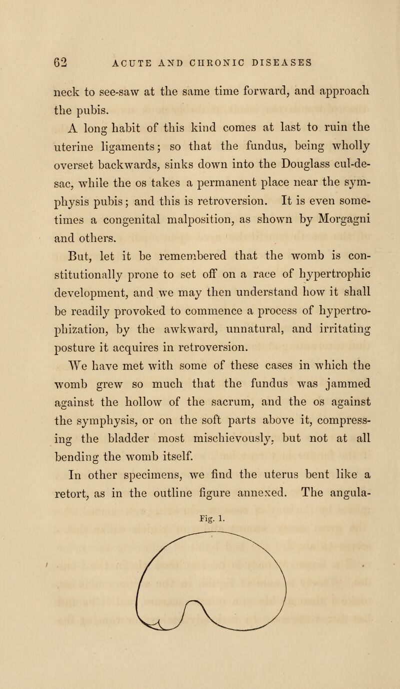 neck to see-saw at the same time forward, and approach the pubis. A long habit of this kind comes at last to ruin the uterine ligaments; so that the fundus, being wholly overset backwards, sinks down into the Douglass cul-de- sac, while the os takes a permanent place near the sym- physis pubis; and this is retroversion. It is even some- times a congenital malposition, as shown by Morgagni and others. But, let it be rememxbered that the womb is con- stitutionally prone to set off on a race of hypertrophic development, and we may then understand how it shall be readily provoked to commence a process of hypertro- phization, by the awkward, unnatural, and irritating posture it acquires in retroversion. We have met with some of these cases in which the womb grew so much that the fundus was jammed against the hollow of the sacrum, and the os against the symphysis, or on the soft parts above it, compress- ing the bladder most mischievously, but not at all bending the womb itself In other specimens, we find the uterus bent like a retort, as in the outline figure annexed. The angula- Fig. 1.