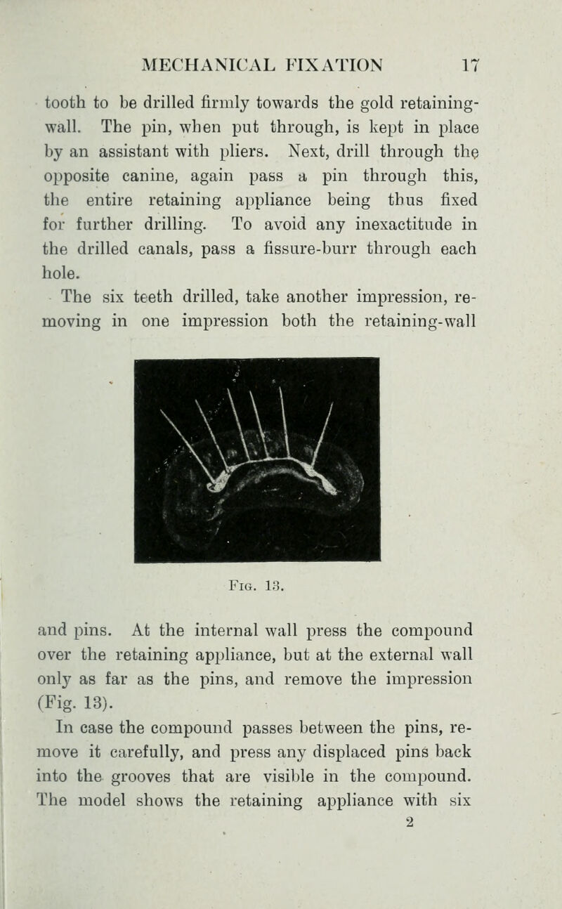 tooth to be drilled firmly towards the gold retainmg- wall. The pin, when put through, is kept in place by an assistant with pliers. Next, drill through the opposite canine, again pass a pin through this, the entire retaining appliance being thus fixed for further drilling. To avoid any inexactitude in the drilled canals, pass a fissure-burr through each hole. The six teeth drilled, take another impression, re- moving in one impression both the retaining-wall Fig. 1:5. and pins. At the internal wall press the compound over the retaining appliance, but at the external wall only as far as the pins, and remove the impression (Fig. 13). In case the compound passes between the pins, re- move it carefully, and press any displaced pins back into the grooves that are visil^le in the compound. The model shows the retaining appliance with six 2