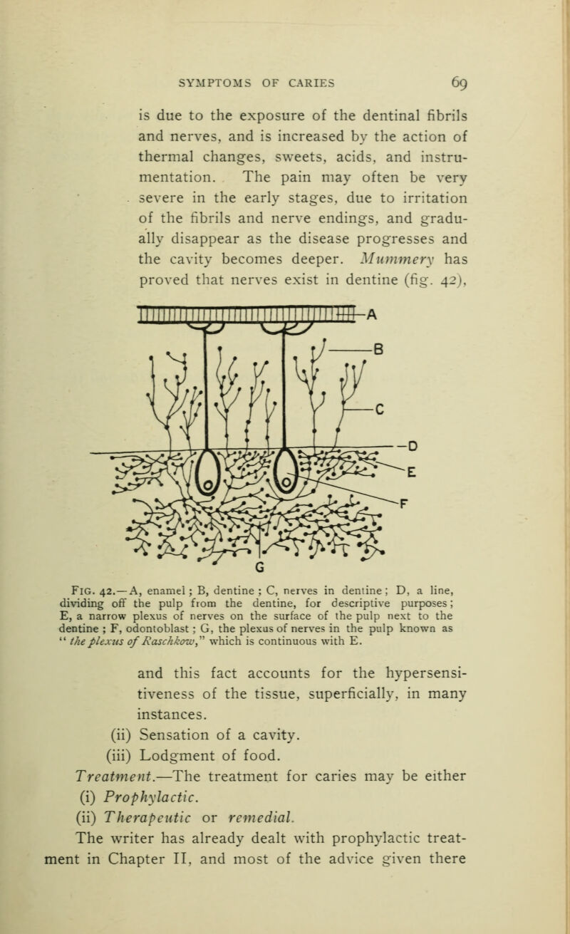 is due to the exposure of the dentinal fibrils and nerves, and is increased by the action of thermal changes, sweets, acids, and instru- mentation. The pain may often be very severe in the early stages, due to irritation of the fibrils and nerve endings, and gradu- ally disappear as the disease progresses and the cavity becomes deeper. Mummery has proved that nerves exist in dentine (fig. 42), mymj^im Fig. 42. —a, enamel; B, dentine ; C, nerves in dentine; D, a line, dividing off the pulp from the dentine, for descriptive purposes; E, a narrow plexus of nerves on the surface of the pulp next to the dentine ; F, odontoblast; G, the plexus of nerves in the pulp known as  the plexus of Raschkozu,^'' which is continuous with E. and this fact accounts for the hypersensi- tiveness of the tissue, superficially, in many instances, (ii) Sensation of a cavity, (iii) Lodgment of food. Treatment.—The treatment for caries may be either (i) Prophylactic. (ii) Therapeutic or remedial. The writer has already dealt with prophylactic treat- ment in Chapter II, and most of the advice given there