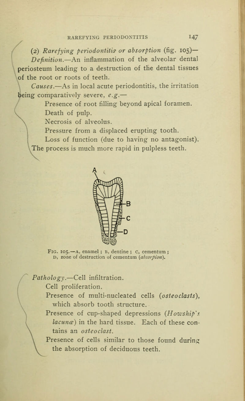 (2) Rarefying periodontitis' or absorption (fig. 105)— Definition.—An inflammation of the alveolar dental periosteum leading to a destruction of the dental tissues ^of the root or roots of teeth. Causes.—As in local acute periodontitis, the irritation Ijeing comparatively severe, e.g.— Presence of root filling beyond apical foramen. Death of pulp. Necrosis of alveolus. Pressure from a displaced erupting tooth. Loss of function (due to having no antagonist). The process is much more rapid in pulpless teeth. Fig. 105.—A, enamel ; B, dentine ; c, cementum ; D, zone of destruction of cementum [absorpion). Pathology.—Cell infiltration. Cell proliferation. Presence of multi-nucleated cells {osteoclasts), which absorb tooth structure. Presence of cup-shaped depressions (Howship\^ lacunar) in the hard tissue. Each of these con- tains an osteoclast. Presence of cells similar to those found durin.s; the absorption of deciduous teeth.