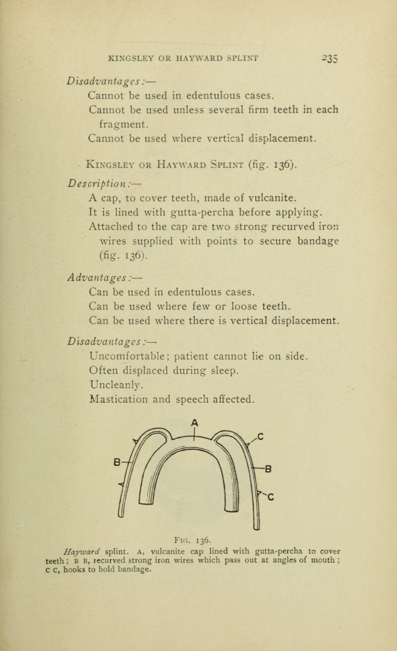 Disadvantages:— Cannot be used in edentulous cases. Cannot be used unless several firm teeth in each fragment. Cannot be used where vertical displacement. • KlXGSLEY OR HaYWARD SpLIXT (fig. I36). Description:— A cap, to cover teeth, made of vulcanite. It is lined with gutta-percha before applying. Attached to the cap are two strong recurved iron wires supplied w^ith points to secure bandage (fig- 136). Advantages:—■ Can be used in edentulous cases. Can be used where few or loose teeth. Can be used where there is vertical displacement. Disadvantages:—• Uncomfortable; patient cannot lie on side. Often displaced during sleep. Uncleanly. Mastication and speech affected. Fit;. 136. Hayward splint. A, vulcanite cap lined with gutta-percha to cover teeth ; b B, recurved strong iron wires which pass out at angles of mouth ; C C, hooks to hold bandage.