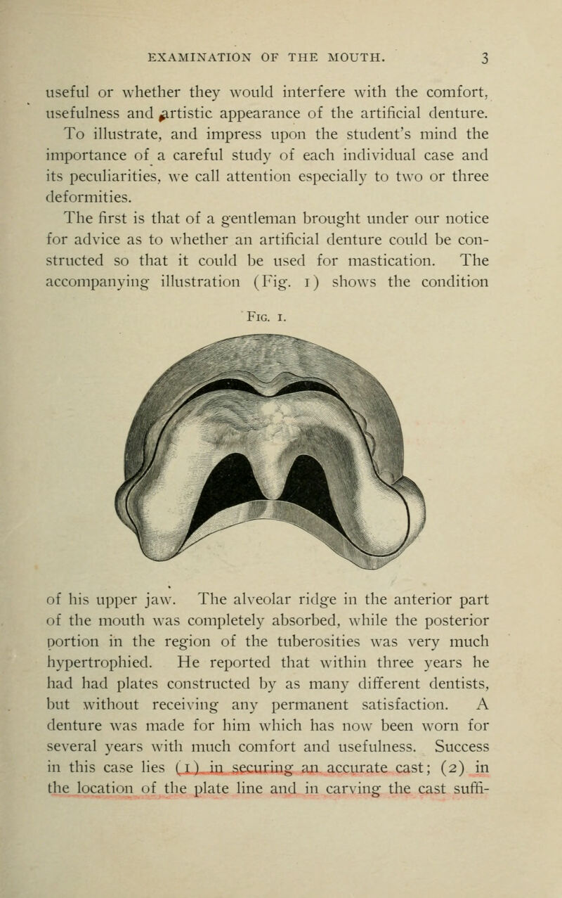 useful or whether they would interfere with the comfort, usefulness and ^rtistic appearance of the artificial denture. To illustrate, and impress upon the student's mind the importance of a careful study of each individual case and its peculiarities, we call attention especially to two or three deformities. The first is that of a gentleman brought under our notice for advice as to whether an artificial denture could be con- structed so that it could be used for mastication. The accompanying illustration (Fig. i) shows the condition Fig. i. of his upper jaw. The alveolar ridge in the anterior part of the mouth was completely absorbed, while the posterior portion in the region of the tuberosities was very much hypertrophied. He reported that within three years he had had plates constructed by as many different dentists, but without receiving any permanent satisfaction. A denture was made for him which has now been worn for several years with much comfort and usefulness. Success in this case lies (i) in securing an accurate cast; (2) in the location of the plate line and in carving the cast sufri-