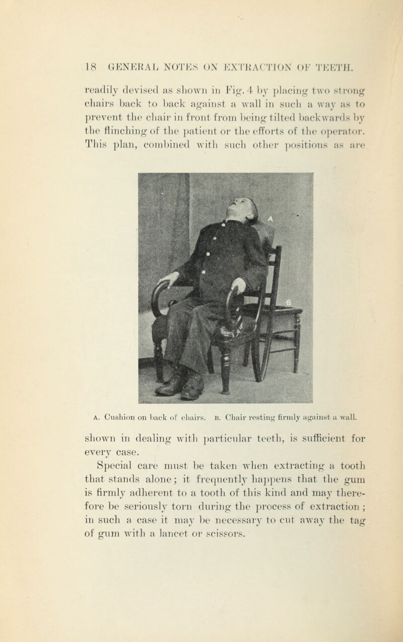 readily devised as shown in Fig.4 by placing two strong chairs back to back againsl a wall in such a way as to prevent tlie chair in froni from being tilted backwards by the flinching of the patient or the efforts of the operator. Tliis plan, combined with such other positions as are A. Cushion on back of chairs, b. Chair resting firmly against a wall. shown in dealing with particular teeth, is sufficient for every case. Special care must be taken when extracting a tooth that stands alone; it frequently happens that the gum is firmly adherent to a tooth of this kind and may there- fore be seriously torn during the process of extraction ; in such a case it may be necessary to cut away the tag of gum with a lancet or scissors.