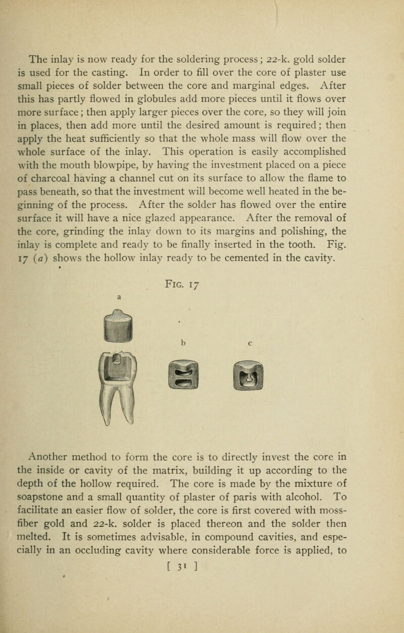 The inlay is now ready for the soldering process; 22-k. gold solder is used for the casting. In order to fill over the core of plaster use small pieces of solder between the core and marginal edges. After this has partly flowed in globules add more pieces until it flows over more surface; then apply larger pieces over the core, so they will join in places, then add more until the desired amount is required; then apply the heat sufficiently so that the whole mass will flow over the whole surface of the inlay. This operation is easily accomplished with the mouth blowpipe, by having the investment placed on a piece of charcoal having a channel cut on its surface to allows the flame to pass beneath, so that the investment will become well heated in the be- ginning of the process. After the solder has flowed over the entire surface it will have a nice glazed appearance. After the removal of the core, grinding the inlay down to its margins and polishing, the inlay is complete and ready to be finally inserted in the tooth. Fig. 17 (fl) shows the hollow inlay ready to be cemented in the cavity. Fig. 17 Another method to form the core is to directly invest the core in the inside or cavity of the matrix, building it up according to the depth of the hollow required. The core is made by the mixture of soapstone and a small quantity of plaster of paris with alcohol. To facilitate an easier flow of solder, the core is first covered with moss- fiber gold and 22-k. solder is placed thereon and the solder then melted. It is sometimes advisable, in compound cavities, and espe- cially in an occluding cavity where considerable force is applied, to