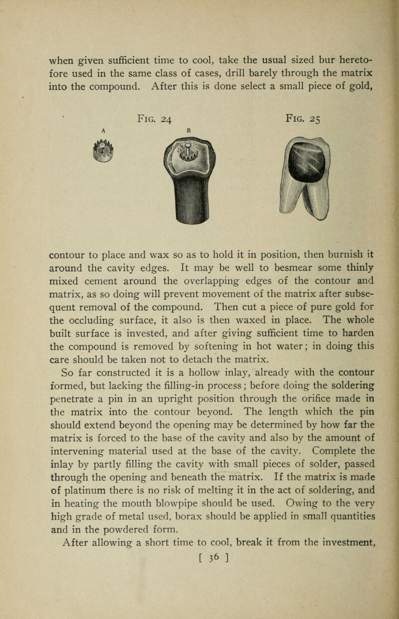 when given sufficient time to cool, take the usual sized bur hereto- fore used in the same class of cases, drill barely through the matrix into the compound. After this is done select a small piece of gold, Fig. 24 Fig. 25 contour to place and wax so as to hold it in position, then burnish it around the cavity edges. It may be well to besmear some thinly mixed cement around the overlapping edges of the contour and matrix, as so doing will prevent movement of the matrix after subse- quent removal of the compound. Then cut a piece of pure gold for the occluding surface, it also is then waxed in place. The whole built surface is invested, and after giving sufficient time to harden the compound is removed by softening in hot water; in doing this care should be taken not to detach the matrix. So far constructed it is a hollow inlay, already with the contour formed, but lacking the filling-in process; before doing the soldering penetrate a pin in an upright position through the orifice made in the matrix into the contour beyond. The length which the pin should extend beyond the opening may be determined by how far the matrix is forced to the base of the cavity and also by the amount of intervening material used at the base of the cavity. Complete the inlay by partly filling the cavity with small pieces of solder, passed through the opening and beneath the matrix. If the matrix is made of platinum there is no risk of melting it in the act of soldering, and in heating the mouth blowpipe should be used. Owing to the very high grade of metal used, borax should be applied in small quantities and in the powdered form. After allowing a short time to cool, break it from the investment,