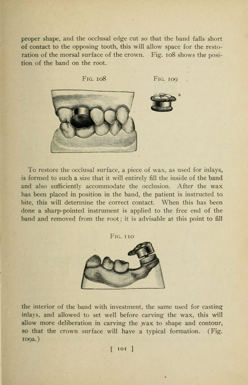 proper shape, and the occlusal edge cut so that the band falls short of contact to the opposing tooth, this will allow space for the resto- ration of the morsal surface of the crown. Fig. io8 shows the posi- tion of the band on the root. Fig. io8 Fig. 109 To restore the occlusal surface, a piece of wax, as used for inlays, is formed to such a size that it will entirely fill the inside of the band and also sufficiently accommodate the occlusion. After the wax has been placed in position in the band, the patient is instructed to bite, this will determine the correct contact. When this has been done a sharp-pointed instrument is applied to the free end of the band and removed from the root; it is advisable at this point to fill Fig. 110 the interior of the band with investment, the same used for casting inlays, and allowed to set well before carving the wax, this will allow more deliberation in carving the wax to shape and contour, so that the crown surface will have a typical formation. (Fig. 109a.) [ loi ]