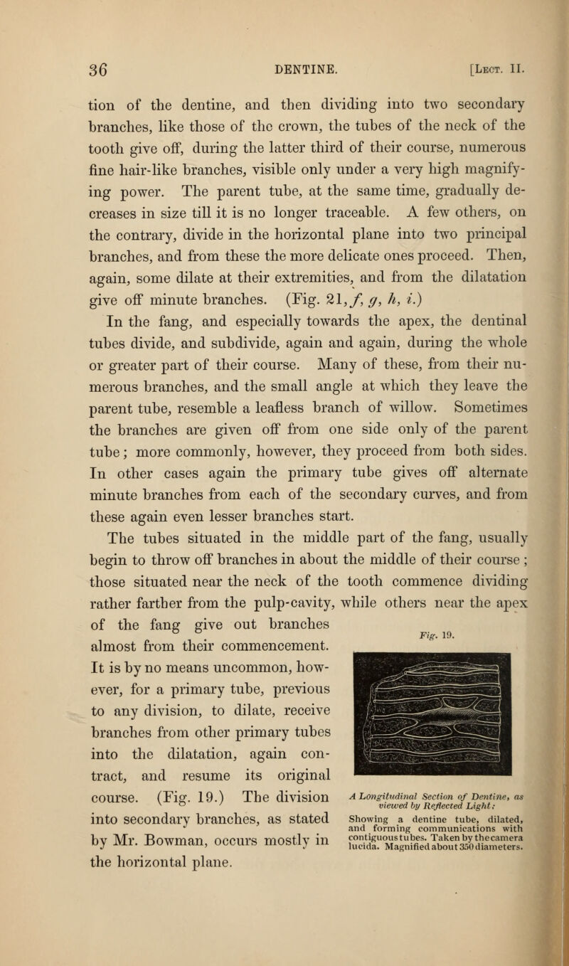 tion of the dentine, and then dividing into two secondary branches, like those of the crown, the tubes of the neck of the tooth give off, during the latter third of their course, numerous fine hair-like branches, visible only under a very high magnify- ing power. The parent tube, at the same time, gradually de- creases in size till it is no longer traceable. A few others, on the contrary, divide in the horizontal plane into two principal branches, and from these the more delicate ones proceed. Then, again, some dilate at their extremities, and from the dilatation give ojff minute branches. (Fig. 21, f, g, h, i.) In the fang, and especially towards the apex, the dentinal tubes divide, and subdivide, again and again, during the whole or greater part of their course. Many of these, from their nu- merous branches, and the small angle at which they leave the parent tube, resemble a leafless branch of willow. Sometimes the branches are given off from one side only of the parent tube; more commonly, however, they proceed from both sides. In other cases again the primary tube gives off alternate minute branches from each of the secondary curves, and from these again even lesser branches start. The tubes situated in the middle part of the fang, usually begin to throw off branches in about the middle of their course ; those situated near the neck of the tooth commence dividing rather farther from the pulp-cavity, while others near the apex of the fang give out branches almost from their commencement. It is by no means uncommon, how- ever, for a primary tube, previous to any division, to dilate, receive branches from other primary tubes into the dilatation, again con- tract, and resume its original course. (Fig. 19.) The division into secondary branches, as stated by Mr. Bowman, occurs mostly in the horizontal plane. f;^. 19. A Longitudinal Section of Dentine, as viewed by Reflected Light ; Showing a dentine tube, dilated, and forming communications with contiguous tubes. Taken by thecamera lucida. Magnified about 3;)0 diameters.