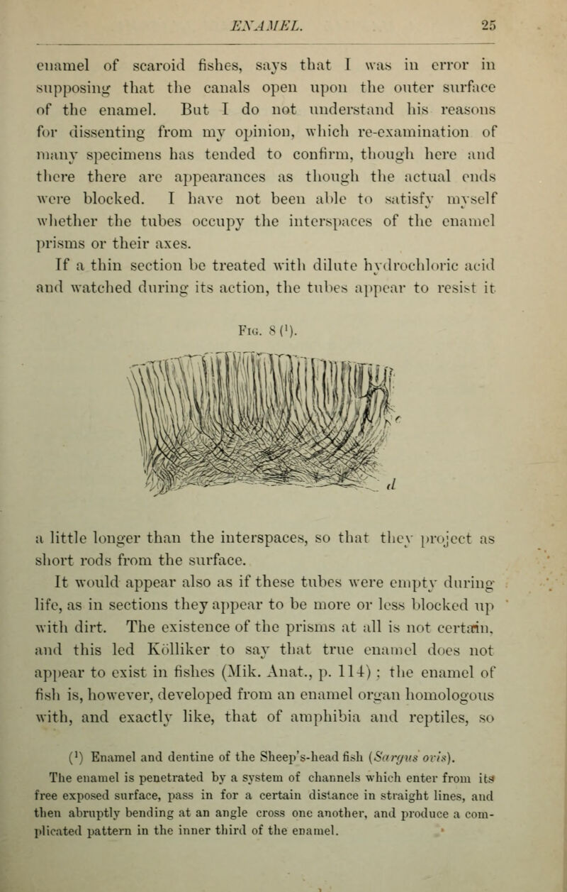 enamel of scaroid fishes, says that T was in error in supposing that the canals open upon the outer sin-face of the enamel. But I do not understand his reasons for dissenting from mv opinion, wliich re-examination of many specimens has tended to confirm, though here and there there are appearances as though the actual ends were blocked. I have not been able to satisfy myself wliether the tubes occupy tlie interspaces of the enamel prisms or their axes. If a thin section be treated with dilate hydrochloric acid and watched during its action, the tubes appear to resist it Fig. S (>). -L>^£^^fe^^g^- ,/ a little longer than the interspaces, so that they [)ro;cct as short rods from the surface. It would appear also as if these tubes were empty during life, as in sections they appear to be more or less blocked up with dirt. The existence of the prisms at all is not certmn, and this led Kolliker to say that true enamel does not appear to exist in fishes (Mik. Anat., p. 114) ; the enamel of fish is, however, developed from an enamel organ homologous with, and exactly like, that of amphibia and reptiles, so (') Enamel and dentine of the Sheep's-head fish {Sarr/vs ovii<). The enamel is penetrated by a system of channels which entei' from it3 free exposed surface, pass in for a certain distance in straight lines, and then abruptly bending at an angle cross one another, and produce a com- plicated pattern in the inner third of the enamel.