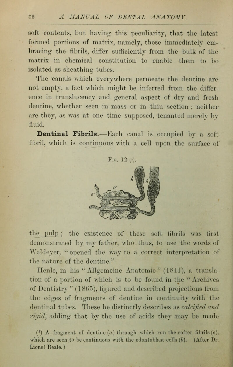 soft contents, but having- this peculiarity, tliat the Litest formed portions of matrix, namely, those immediately em- bracing the fibrils, differ sufficiently from the bulk of the matrix in chemical constitution to enable them to be isolated as sheathing tubes. The canals which everywhere j^ermeate the dentine are not empty, a fact which might be inferred from the difter- ence in translucency and general aspect of dry and fresh dentine, whether seen in mass or in thin section : neither are they, as was at one time supposed, tenanted merely by fluid. Dentinal Fibrils.—Each canal is occui)ied l)y a soft fibril, whicli is continuous with a cell upon the surfiice of Fm;. 12 0;. the pulp; the existence of these soft fibrils was first demonstrated by my father, who thus, to use the words of Waldeyer,  opened the way to a correct interpretation of the nature of the dentine. Henle, in his Allgemeine Anatomic (1S41), a transla- tion of a portion of which is to be found in the  Arcliives of Dentistr}'  (186.5), figured and described projections from the edges of fragments of dentine in continuity with the dentinal tubes. These he distinctly describes as valcijied and rigid, adding that by the use of acids they may be made- (') A fragment of dentine (^'/Mhvongli Avliich run tbe softer fibrils (c), which are seen to be continuous with the odontoblast cells {/>). (After Dr. Lionel Beale.)