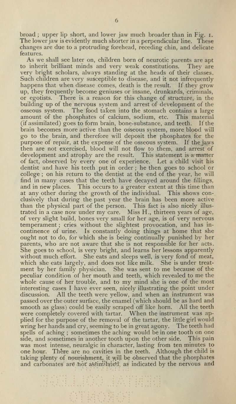 broad ; upper lip short, and lower jaw much broader than in Fig. i. The lower jaw is evidently much shorter in a perpendicular line. These changes are due to a protruding forehead, receding chin, and delicate features. As we shall see later on, children born of neurotic parents are apt to inherit brilliant minds and very weak constitutions. They are very bright scholars, always standing at the heads of their classes. Such children are very susceptible to disease, and it not infrequently happens that when disease comes, death is the result. If they grow up, they frequently become geniuses or insane, drunkards, crimmals, or egotists. There is a reason for this change of structure, in the building up of the nervous system and arrest of development of the osseous system. The food taken into the stomach contains a large amount of the phosphates of calcium, sodium, etc. This material (if assimilated) goes to form brain, bone-substance, and teeth. If the brain becomes more active than the osseous system, more blood will go to the brain, and therefore will deposit the phosphates for the purpose of repair, at the expense of the osseous system. If the jaws then are not exercised, blood will not flow to them, and arrest of development and atrophy are the result. This statement is a matter of fact, observed by every one of experience. Let a child visit his dentist and have his teeth put in order ; he then goes to school or college ; on his return to the dentist at the end of the year, he will find in many cases that the teeth have decayed around the fillings, and in new places. This occurs to a greater extent at this time than at any other during the growth of the individual. This shows con- clusively that during the past year the brain has been more active than the physical part of the person. This fact is also nicely illus- trated in a case now under my care. Miss H., thirteen years of age, of very slight build, bones very small for her age, is of very nerv'ous temperament ; cries without the slightest provocation, and has in- continence of urine. Is constantly doing things at home that she ought not to do, for which she is being continually punished by her parents, who are not aware that she is not responsible for her acts. She goes to school, is very bright, and learns her lessons apparently without much effort. She eats and sleeps well, is very fond of meat, which she eats largely, and does not like milk. She is under treat- ment by her family physician. She was sent to me because of the peculiar condition of her mouth and teeth, which revealed to me the whole cause of her trouble, and to my mind she is one of the most interesting cases I have ever seen, nicely illustrating the point under discussion. All the teeth were yellow, and when an instrument was passed over the outer surface, the enamel (which should be as hard and smooth as glass) could be easily scraped off like horn. All the teeth were completely covered with tartar. When the instrument was ap- plied for the purpose of the removal of the tartar, the little girl would wring her hands and cry, seeming to be in great agony. The teeth had spells of aching ; sometimes the aching would be in one tooth on one side, and sometimes in another tooth upon the other side. This pain was most intense, neuralgic in character, lasting from ten minutes to one hour. There are no cavities in the teeth. Although the child is taking plenty of npuri^hm-ent, it/vvill be observed that the phosphates and carbonates are hot a?5§irnil^te*d; as indicated by the nervous and