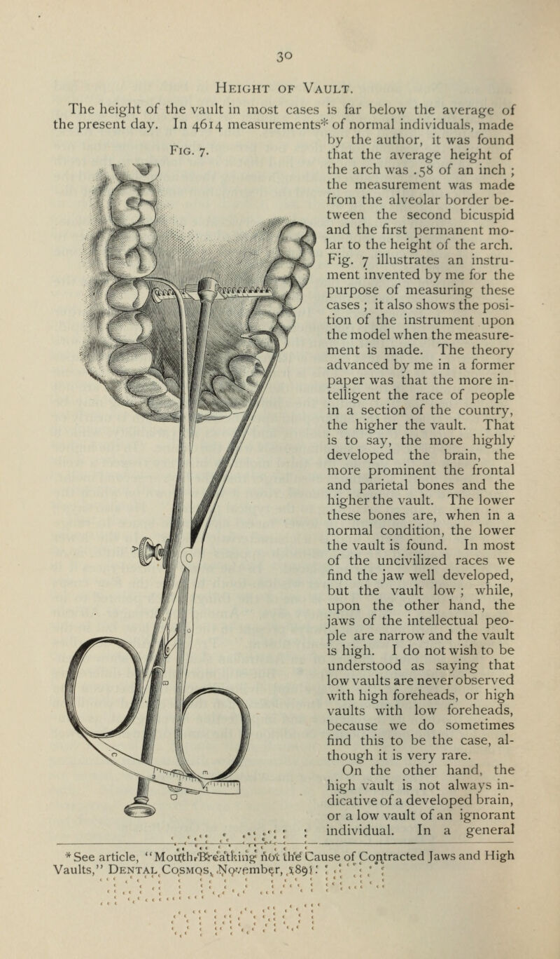 Height of Vault. The height of the vault in most cases is far below the average of the present day. In 4614 measurements^ of normal individuals, made by the author, it was found Fig. 7. that the average height of the arch was .58 of an inch ; the measurement was made from the alveolar border be- tween the second bicuspid and the first permanent mo- lar to the height of the arch. Fig. 7 illustrates an instru- ment invented by me for the purpose of measuring these cases ; it also shows the posi- tion of the instrument upon the model when the measure- ment is made. The theory advanced by me in a former paper was that the more in- telligent the race of people in a section of the country, the higher the vault. That is to say, the more highly developed the brain, the more prominent the frontal and parietal bones and the higher the vault. The lower these bones are, when in a normal condition, the lower the vault is found. In most of the uncivilized races we find the jaw well developed, but the vault low ; while, upon the other hand, the jaws of the intellectual peo- ple are narrow and the vault is high. I do not wish to be understood as saying that low vaults are never observed with high foreheads, or high vaults with low foreheads, because we do sometimes find this to be the case, al- though it is very rare. On the other hand, the high vault is not always in- dicative of a developed brain, or a low vault of an ignorant individual. In a general ^ ., , ,•«*.; '. inaiviQuai. in a general —_ l,_'_4_i—«_!,—..^jSpj-I-I—« ——— * See article, '' MoKthr'Krea'tfein^ Aot th'e' Cause of Co,i\tracted Jaws and High Vaults, Dental CqsMQS^ .T^^pvpmb^r, ,5,89)