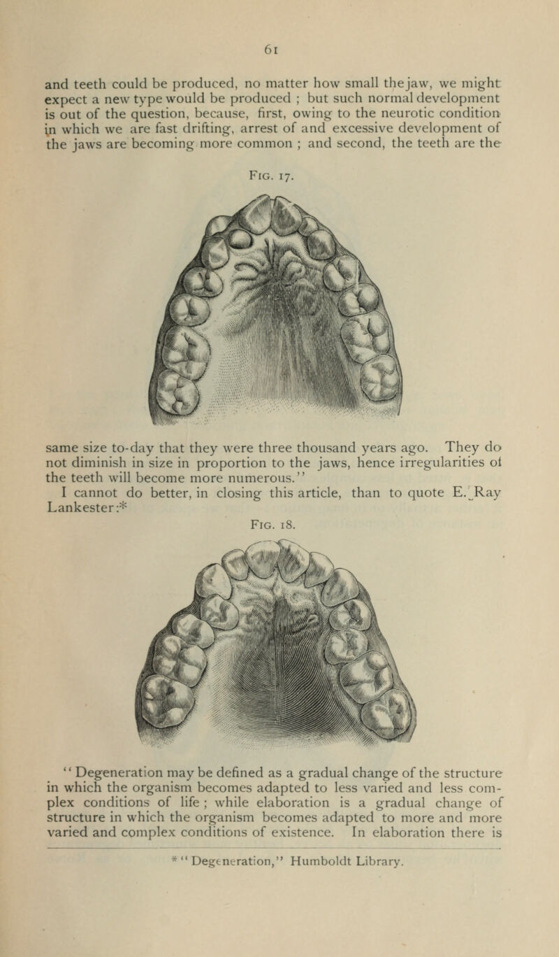 and teeth could be produced, no matter how small thejaw, we might expect a new type would be produced ; but such normal development is out of the question, because, first, owing to the neurotic condition in which we are fast drifting, arrest of and excessive development of the jaws are becoming more common ; and second, the teeth are the Fig. 17. same size to-day that they were three thousand years ago. They do not diminish in size in proportion to the jaws, hence irregularities oi the teeth will become more numerous. I cannot do better, in closing this article, than to quote E.^Ray Lankester:* Fig. 18.  Degeneration may be defined as a gradual change of the structure in which the organism becomes adapted to less varied and less com- plex conditions of life ; while elaboration is a gradual change of structure in which the organism becomes adapted to more and more varied and complex conditions of existence. In elaboration there is * «< Degeneration, Humboldt Library.