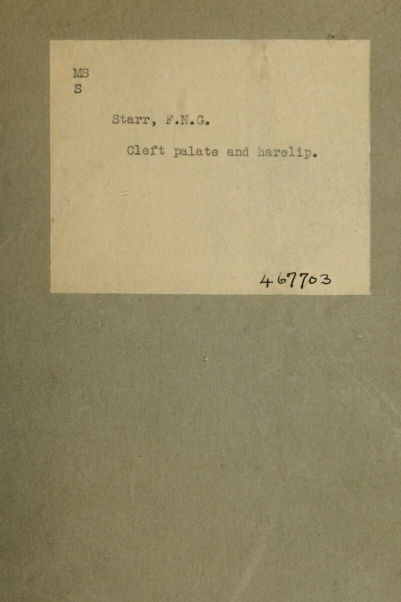 1.13 S Starr, i?\K,a. Cleft palate and harelip. li-^Tfo^