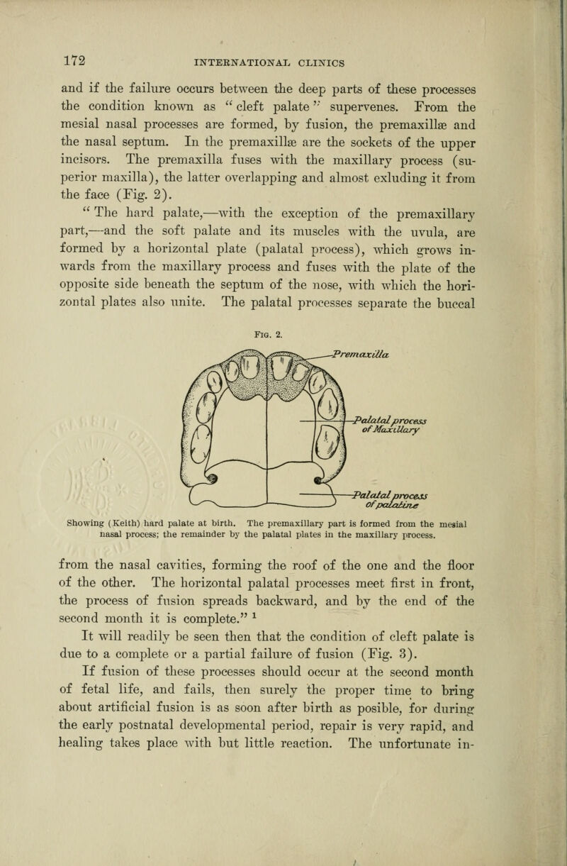 and if the failure occurs between the deep parts of these processes the condition known as  cleft palate' supervenes. From the mesial nasal processes are formed, by fusion, the premaxillae and the nasal septum. In the premaxillse are the sockets of the upper incisors. The premaxilla fuses with the maxillary process (su- perior maxilla), the latter overlapping and almost exluding it from the face (Fig. 2).  The hard palate,—with the exception of the premaxillary part,—and the soft palate and its muscles with tlie uvula, are formed by a horizontal plate (palatal process), which grows in- wards from the maxillary process and fuses with the plate of the opposite side beneath the septum of the nose, with which the hori- zontal plates also unite. The palatal processes separate the buccal Fig. 2. -Premaxilla ■Palatalprocess of MaxtUajy italproce-i ofpalaiing Showing (Keith) hard palate at birth. The premaxillary part is formed from the mesial nasal process; the remainder by the palatal plates in the maxillary process. from the nasal cavities, forming the roof of the one and the floor of the other. The horizontal palatal processes meet first in front, the process of fusion spreads backward, and by the end of the second month it is complete. ^ It will readily be seen then that tlie condition of cleft palate is due to a complete or a partial failure of fusion (Fig. 3). If fusion of these processes should occur at the second month of fetal life, and fails, then surely the proper time to bring about artificial fusion is as soon after birth as posible, for during the early postnatal developmental period, repair is very rapid, and healing takes place with but little reaction. The unfortunate in-