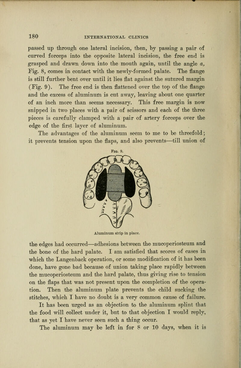 passed up through one lateral incision, then, by passing a pair of curved forceps into the opposite lateral incision, the free end is grasped and drawn down into the mouth again, until the angle a, Fig. 8, comes in contact with the newly-formed palate. The flange is still further bent over until it lies flat against the sutured margin (Fig. 9). The free end is then flattened over the top of the flange and the excess of aluminum is cut away, leaving about one quarter of an inch more than seems necessary. This free margin is now snipped in two places with a pair of scissors and each of the three pieces is carefully clamped with a pair of artery forceps over the edge of the first layer of aluminum. The advantages of the aluminum seem to me to be threefold; it prevents tension upon the flaps, and also prevents—till union of Fig. 9. Aluminum strip in place. the edges had occurred—adhesions between the mucoperiosteum and the bone of the hard palate. I am satisfied that scores of cases in which the Langenback operation, or some modification of it has been done, have gone bad because of union taking place rapidly between the mucoperiosteum and the hard palate, thus giving rise to tension on the flaps that was not present upon the completion of the opera- tion. Then the aluminum plate prevents the child sucking the stitches, which I have no doubt is a very common cause of failure. It has been urged as an objection to the aluminum splint that the food will collect under it, but to that objection I would reply, that as yet I have never seen such a thing occur. The aluminum may be left in for 8 or 10 days, when it is