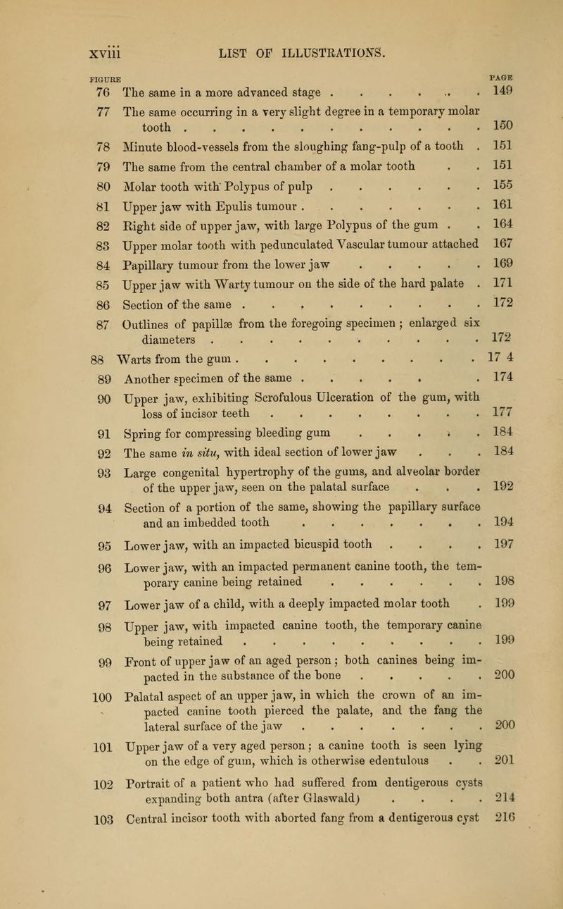 FIGURE PAGE 76 The same in a more advanced stage 149 77 The same occurring in a very slight degree in a temporary molar tooth 150 78 Minute blood-vessels from the sloughing fang-pulp of a tooth . 151 79 The same from the central chamber of a molar tooth . . 151 80 Molar tooth with' Polypus of pulp 15-5 81 Upper javt^ with Epulis tumour 161 82 Right side of upper jaw, with large Polypus of the gum . . 164 83 Upper molar tooth with pedunculated Vascular tumour attached 167 84 Papillary tumour from the lower jaw 169 85 Upper jaw with Warty tumour on the side of the hard palate . 171 86 Section of the same 172 87 Outlines of papillae from the foregoing specimen ; enlarged six diameters . 172 88 Warts from the gum 17 4 89 Another specimen of the same . 174 90 Upper jaw, exhibiting Scrofulous Ulceration of the gum, with loss of incisor teeth 177 91 Spring for compressing bleeding gum . . , i . 184 92 The same m se'i^w, with ideal section of lower jaw . . . 184 93 Large congenital hypertrophy of the gums, and alveolar border of the upper jaw, seen on the palatal surface . . . 192 94 Section of a portion of the same, showing the papillary surface and an imbedded tooth 194 95 Lower jaw, with an impacted bicuspid tooth .... 197 96 Lower jaw, with an impacted permanent canine tooth, the tem- porary canine being retained 198 97 Lower jaw of a child, with a deeply impacted molar tooth . 199 98 Upper jaw, with impacted canine tooth, the temporary canine being retained 199 99 Front of upper jaw of an aged person; both canines being im- pacted in the substance of the bone ..... 200 100 Palatal aspect of an upper jaw, in which the crown of an im- pacted canine tooth pierced the palate, and the fang the lateral surface of the jaw 200 101 Upper jaw of a very aged person ; a canine tooth is seen lying on the edge of gum, which is otherwise edentulous . . 201 102 Portrait of a patient who had suffered from deutigerous cysts expanding both antra (after Glaswald) . . . .214 103 Central incisor tooth with aborted fang from a dentigerous cyst 216