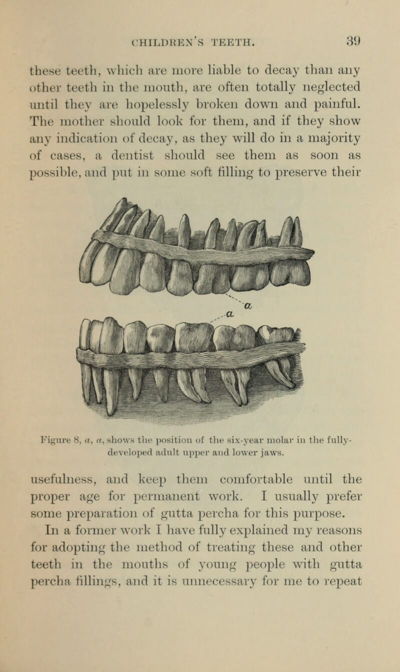 these teeth, which are more Hable to decay than any other teeth in the nioutli, are often totally neglected until they are hopelessly broken down and painful. The mother should look for them, and if they show any indication of decay, as they will do in a majority of cases, a dentist should see them as soon as possible, and ]int in some soft filling to preserve their Figure S, a, a, shows the position of the six-year molar in the fvilly- develo})ed adult upper and lower jaws. usefulness, and keep tliem comfortable until the proper age for permanent work. I usually prefer some preparation of gutta percha for this purpose. In a former work I have fully explained my reasons for adopting the method of treating these and other teeth in the mouths of young people with gutta percha fillings, and it is unnecessary for me to repeat
