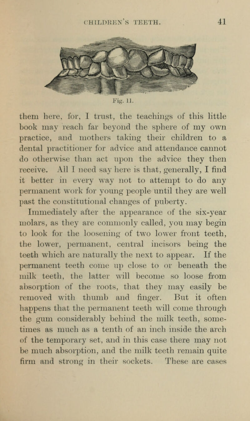 i^'ig. li. them here, for, I trust, the teachings of this httle book may reach far beyond the sphere of my own practice, and mothers taking their children to a dental practitioner for advice and attendance cannot do otherwise than act upon the advice they then receive. Ail T need say here is that, generally, I find it better in every way not to attempt to do any permanent work for young people until they are well past the constitutional changes of puberty. Immediately after the appearance of the six-year molars, as they are commonly called, you may begin to look for the loosening of two lower fi'ont teeth, the lower, permanent, central incisors being the teeth which are naturally the next to appear. If the permanent teeth come up close to or beneath the milk teeth, the latter will become so loose from absorption of the roots, that they may easily be removed with thumb and finger. But it often happens tliat the permanent teeth will come through the gum considerably behind the milk teeth, some- times as much as a tenth of an inch inside the arch of the temporary set, and in this case there may not be much absorption, and the milk teeth remain quite firm and stron<: in their sockets. These are cases