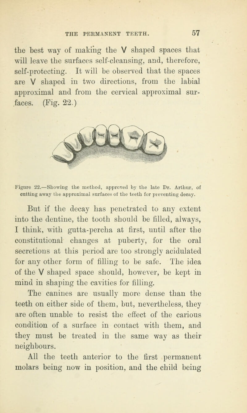 the best way of making the V shaped spaces that will leave the surfaces self-cleansing, and, therefore, self-protecting. It will be observed that the spaces are V shaped in two directions, from the labial approximal and from the cervical approximal sur- faces. (Fig. 22.) Figure 22.—Showing the method, approved by the late Dr. Arthur, of cutting away the approximal surfaces of the teeth for preventing decay. But if the decay has penetrated to any extent into the dentine, the tooth should be filled, always, I think, with gutta-percha at first, until after the constitutional changes at puberty, for the oral secretions at this period are too strongly acidulated for any other form of filling to be safe. The idea of the V shaped space should, however, be kept in mind in shaping the cavities for filling. The canines are usually more dense than the teeth on either side of them, but, nevertheless, they are often unable to resist the effect of the carious condition of a surface in contact with them, and they must be treated in the same way as their neighbours. All the teeth anterior to the first permanent molars being now in position, and the child being