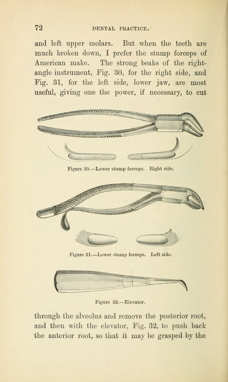 and left upper molars. But when the teeth are much broken down, I prefer the stump forceps of American make. The strong beaks of the right- angle instrument, Fig. 30, for the right side, and Fig. 31, for the left side, lower jaw, are most useful, giving one the power, if necessary, to cut Figure 30.—Lower stump forceps. Right side. Figure 31.—Lower stump forceps. Left side. Figure 32.—Elevator. through the alveolus and remove the posterior root, and then with the elevator, Fig. 32, to push back the anterior root, so that it may be grasped by the
