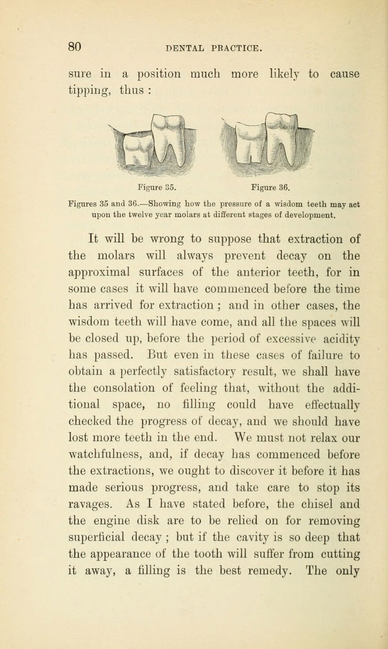 sure in a position much more likely to cause tipping, thus : ■'jRli'i' Figure 35. Figure 36. Figures 35 and 36.—Showing how the pressure of a wisdom teeth may act upon the twelve year molars at different stages of development. It will be wrong to suppose that extraction of the molars will always prevent decay on the approximal surfaces of the anterior teeth, for in some cases it will have commenced before the time has arrived for extraction ; and in other cases, the wisdom teeth will have come, and all the spaces will be closed up, before the period of excessive acidity has passed. But even in these cases of failure to obtain a perfectly satisfactory result, we shall have the consolation of feeling that, without the addi- tional space, no tilling could have effectually checked the progress of decay, and we should have lost more teeth in the end. We must not relax our watchfulness, and, if decay has commenced before the extractions, we ought to discover it before it has made serious progress, and take care to stop its ravages. As I have stated before, the chisel and the engine disk are to be relied on for removing superficial decay ; but if the cavity is so deep that the appearance of the tooth will suffer from cutting it away, a filling is the best remedy. The only