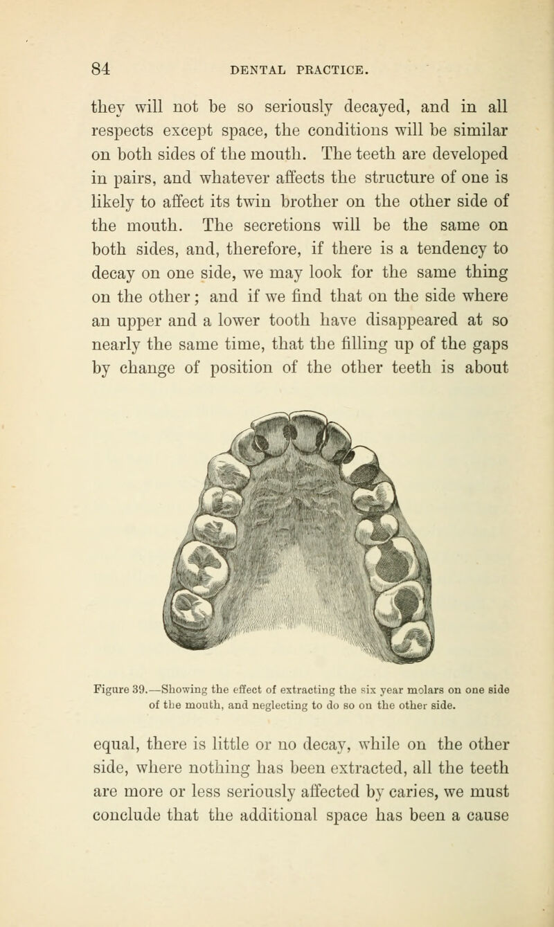 they will not be so seriously decayed, and in all respects except space, the conditions will be similar on both sides of the mouth. The teeth are developed in pairs, and whatever affects the structure of one is likely to affect its twin brother on the other side of the mouth. The secretions will be the same on both sides, and, therefore, if there is a tendency to decay on one side, we may look for the same thing on the other; and if we find that on the side where an upper and a lower tooth have disappeared at so nearly the same time, that the filling up of the gaps by change of position of the other teeth is about Figure 39.—Showing the effect of extracting the six year molars on one side of tbe mouth, and neglecting to do so on the other side. equal, there is little or no decay, while on the other side, where nothing has been extracted, all the teeth are more or less seriously affected by caries, we must conclude that the additional space has been a cause
