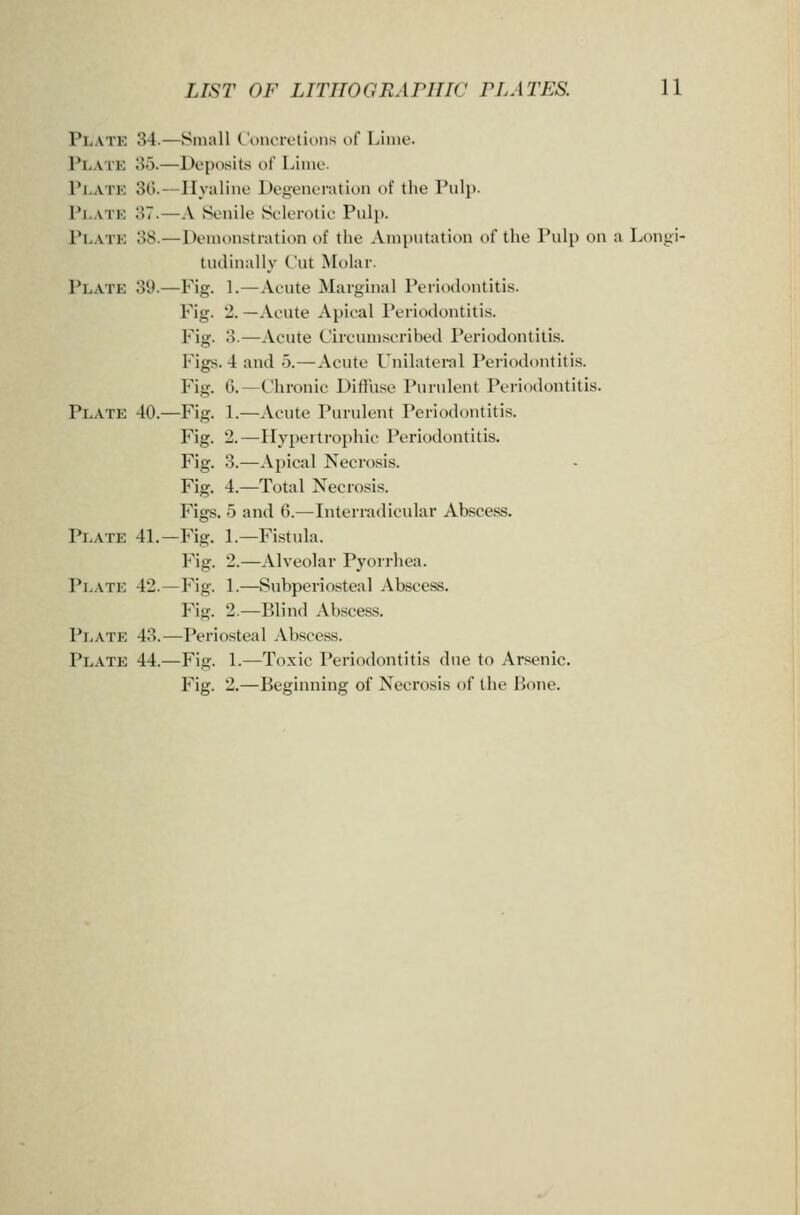 Platk 34.—Small Concretions of Lime. Plate 85.—Depo.sit,s of Linio. Platk 30.—Hyaline Degeneration of tlie Pulp. Platk 37.—A (Senile Sclerotic Puli). Platk 38.—Demonstration of the Amputation of the Pulp on a Longi- tudinally Cut Molar. Platk 39.—Fig. 1.—Acute Marginal Periodontitis. Fig. 2. —Acute Apical Periodontitis. Fig. 3.—Acute Circumscribed Periodontitis. Figs. 4 and 5.—Acute Unilatenil Periodontitis. Fig. 6.—Chronic Diffuse Purulent Periodontitis. Plate 40.—Fig. 1.—Acute Purulent Periodontitis. Fig. 2.—Hypertrophic Periodontitis. Fig. 3.—Apical Necrosis. Fig. 4.—Total Necrosis. Figs. 5 and 6.—Interradicular Abscess. Plate 41.—Fig. 1.—Fistula. Fig. 2.—Alveolar Pyorrhea. Plate 42.—Fig. 1.—Subperiosteal Abscess. V\». 2.—Blind Abscess. Platk 43.—Periosteal Abscess. Platk 44.—Fig. 1.—Toxic Periodontitis due to Arsenic. Fig. 2.—Beginning of Necrosis of the Bone.