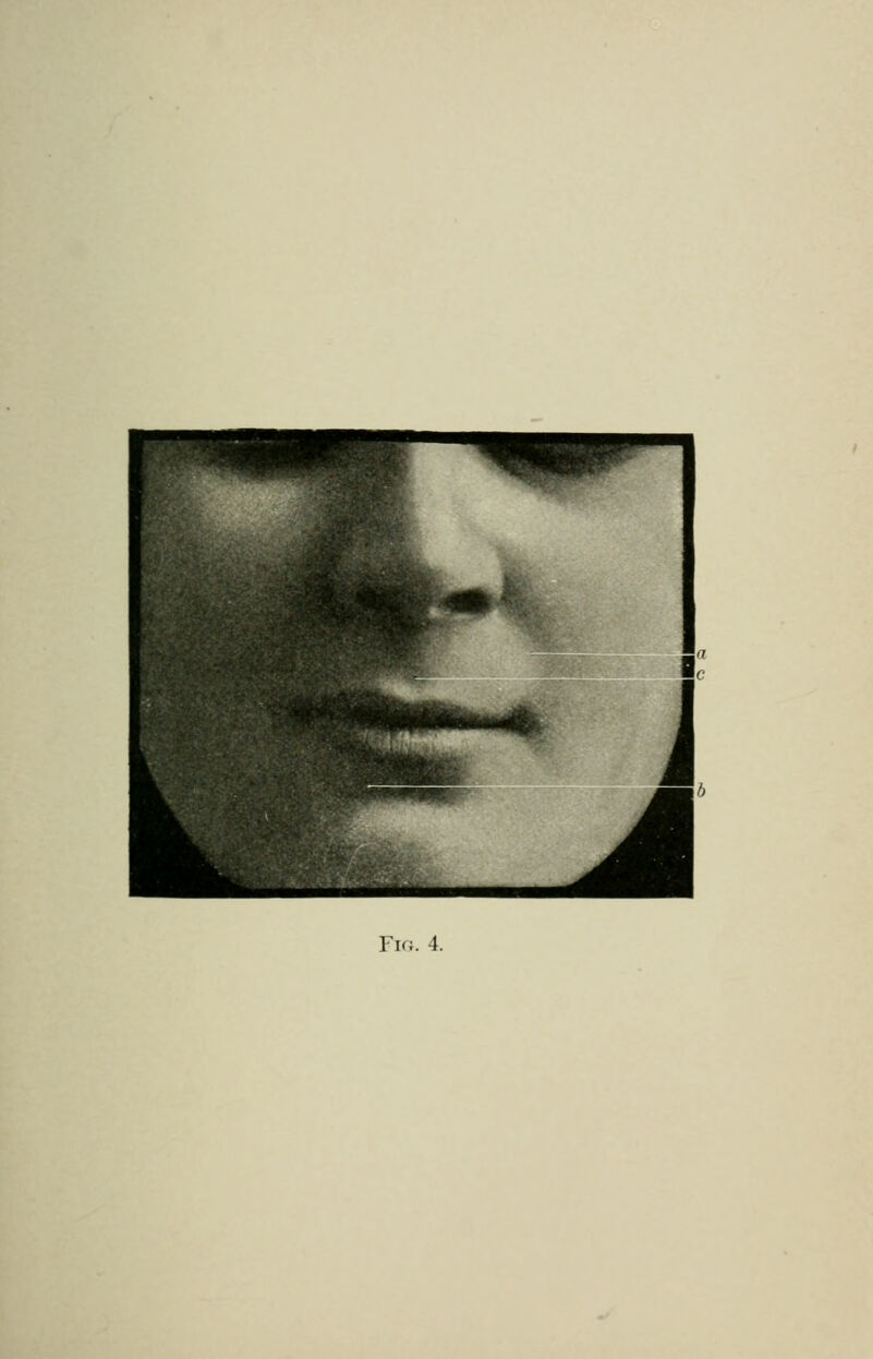 Fk;. 4.
