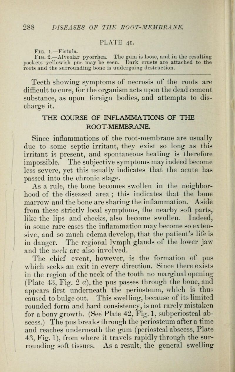 PLATE 41. Fig. 1.—Fistula. Fig. 2.—Alveolar pyorrhea. The gum is loose, and in the resulting pockets yellowish pus may be seen. Dark crusts are attached to the roots and the surrounding bone is undergoing destruction. Teeth showing symptoms of necrosis of the roots are difficult to cure, for the organism acts upon the dead cement substance, as upon foreign bodies, and attempts to dis- charge it. THE COURSE OF INFLAMMATIONS OF THE ROOT-MEMBRANE. Since inflammations of the root-membrane are usually due to some septic irritant, tliey exist so long as this irritant is present, and spontaneous healing is therefore impossible. The subjective symptoms mayindeed become less severe, yet this usually indicates that the acute has passed into the chronic stage. As a rule, the bone becomes swollen in the neighbor- hood of the disea.sed area ; this indicates that the bone marrow and the bone are sharing the inflammation. Aside from these strictly local symptoms, the nearby soft parts, like the lips and cheeks, also become swollen. Indeed, in some rare cases the inflammation may become so exten- sive, and so much edema develop, that the patient's life is in danger. The regional lymph glands of the lower jaw and the neck are also involved. The chief event, however, is the formation of pus which seeks an exit in every direction. Since there exists in the region of the neck of the tooth no marginal opening (Plate 43, Fig. 2 a), the pus passes through the bone, and appears first underneath the periosteum, which is thus caused to bulge out. This swelling, because of its limited rounded form and hard consistency, is not rarely mistaken for a bony growth. (See Plate 42, Fig. 1, subperiosteal ab- scess.) The pus breaks through the periosteum after a time and reaches underneath the gum (periosteal abscess, Plate 43, Fig. 1), from where it travels rapidly through the sur- rounding soft tissues. As a result, the general swelling