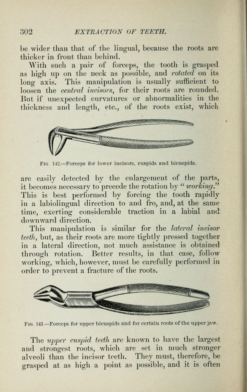 he wider than that of the lingual, because the roots are thicker in front than behind. With such a pair of forceps, the tooth is grasped as high up on the neck as possible, and rotated on its long axis. This manipulation is usually sufficient to loosen the central incisors, for their roots are rounded. But if unexpected curvatures or abnormalities in the thickness and length, etc., of the roots exist, which Fig 112.—Forceps for lower incisors, cuspids and bicuspids. are easily detected by the enlargement of the parts, it becomes necessary to precede the rotation by *' working. This is best performed by forcing the tooth rapidly in a labiolingual direction to and fro, and, at the same time, exerting considerable traction in a labial and downward direction. This manipulation is similar for the lateral incisor teeth, but, as their roots are more tightly pressed together in a lateral direction, not much assistance is obtained through rotation. Better results, in that case, follow working, which, however, must be carefully performed in order to prevent a fracture of the roots. Fio. 143—Forceps for upper bicuspids and for certain roots of the upper jaw. The ivpjyer cuspid teeth are known to have the largest and strongest roots, which are set in much stronger alveoli than the incisor teeth. They must, therefore, be grasped at as high a point as possible, and it is often