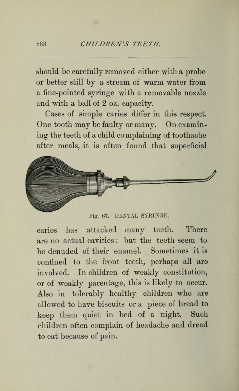 should be carefully removed either with a probe or better still by a stream of warm water from a fine-pointed syringe with a removable nozzle and with a ball of 2 oz. capacity. Cases of simple caries differ in this respect. One tooth may be faulty or many. On examin- ing the teeth of a child complaining of toothache after meals, it is often found that superficial Fig. 67. DEXTAL SYRINGE. caries has attacked many teeth. There are no actual cavities: but the teeth seem to be denuded of their enamel. Sometimes it is confined to the front teeth, perhaps all are involved. In children of weakly constitution, or of weakly parentage, this is likely to occur. Also in tolerably healthy children who are allowed to have biscuits or a piece of bread to keep them quiet in bed of a night. Such children often complain of headache and dread to eat because of pain.
